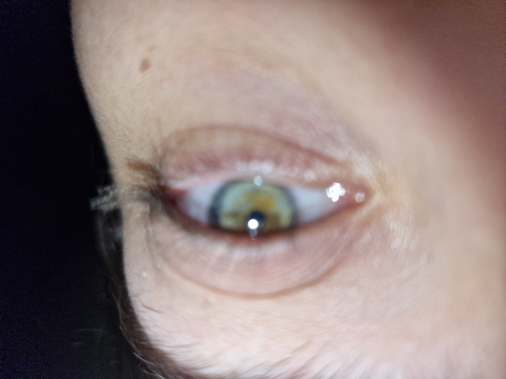 A close-up image shows a human eye with green and yellow irises. The eye is surrounded by skin and eyelashes. A mole is visible on the upper eyelid. The image is slightly out of focus, and reflections are visible in the eye. The background is dark and indistinct. The city and specific location are unknown.