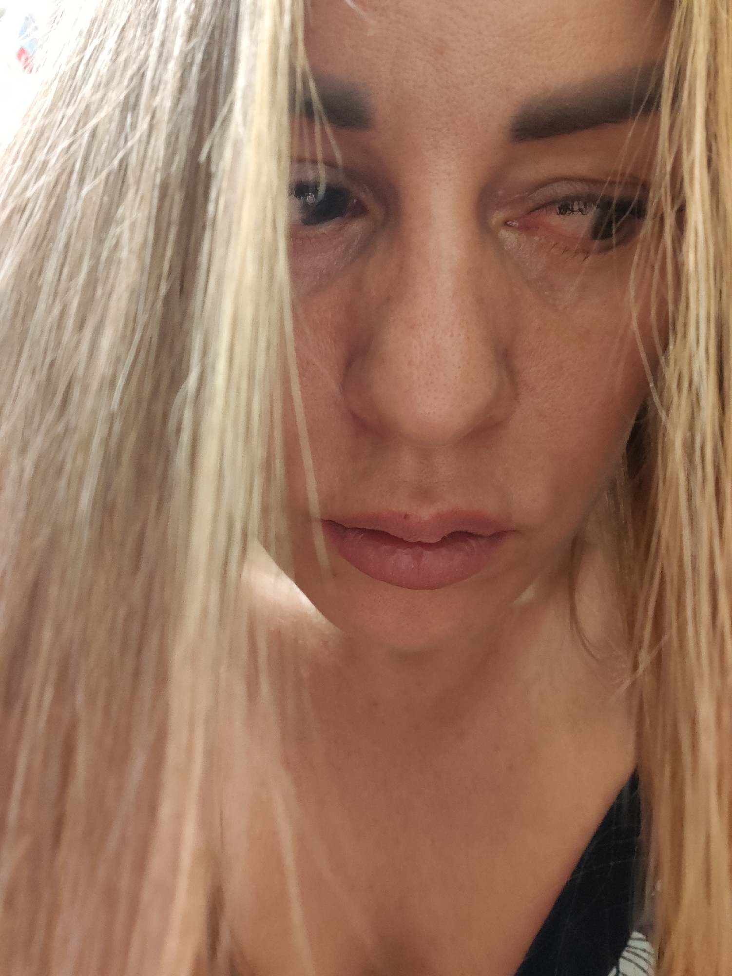 The image shows a close-up, frontal, low-angle shot of a fair-skinned woman's face, with her blonde hair obscuring portions of her features. Her right eye is partially closed and appears red and irritated, with visible under-eye bags. Her left eye is also partly obscured by her hair. Her lips are slightly parted, revealing a neutral or slightly downturned expression. The lighting is soft and diffused, casting a gentle glow on her skin. The background is indistinct, suggesting an indoor setting. There is no discernible information about the location in Almaty, Kazakhstan.
