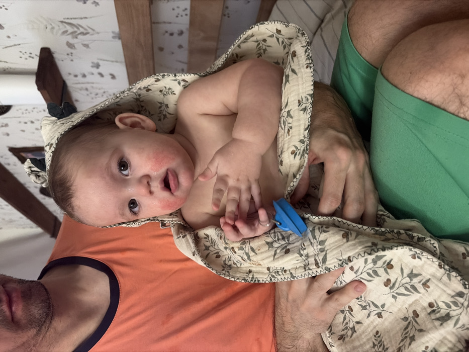 An intimate, close-up image captures an adult holding a baby indoors. The image is oriented such that the baby is positioned horizontally across the frame, being cradled by the adult whose body is partially visible.
The baby, appearing to be a young infant, has fair skin, dark eyes, and light brown hair. They are looking directly towards the viewer with a curious and slightly open-mouthed expression, revealing a bit of their tongue. Notably, there are visible patches of reddish skin on the baby's cheeks and around the chin, possibly indicative of a rash or skin irritation. The baby is snugly wrapped in a light-colored, hooded blanket adorned with a delicate botanical pattern of green leaves and small brown berries or olives. The hood is up, framing the baby's head. The baby's left hand is visible, partially curled, and wears a small, thin ring on one finger. A bright blue plastic clip is attached to the blanket near the baby's hand.
Parts of the adult holding the baby are visible. On the bottom left, the adult's chin and mouth are seen, along with their shoulder and arm covered by an orange t-shirt with a dark navy trim around the collar. A hairy hand and arm support the baby from below. On the right side of the image, another hairy arm and hand, presumably belonging to the same adult, are also visible, further supporting the baby. The adult's upper legs, covered in light green shorts or swim trunks, are seen on the far right.
The background is soft and slightly out of focus, suggesting an indoor setting. In the upper left quadrant, there is a light-colored surface with a subtle, diffuse pattern, possibly a wall or bedding, next to a brown wooden structure, which could be part of furniture like a crib or a chair. The lighting appears soft and even, typical of an indoor environment.
The overall scene conveys a tender moment of care and connection between the adult and the baby, with the baby engaging directly with the camera. There is no visible text in the image.
