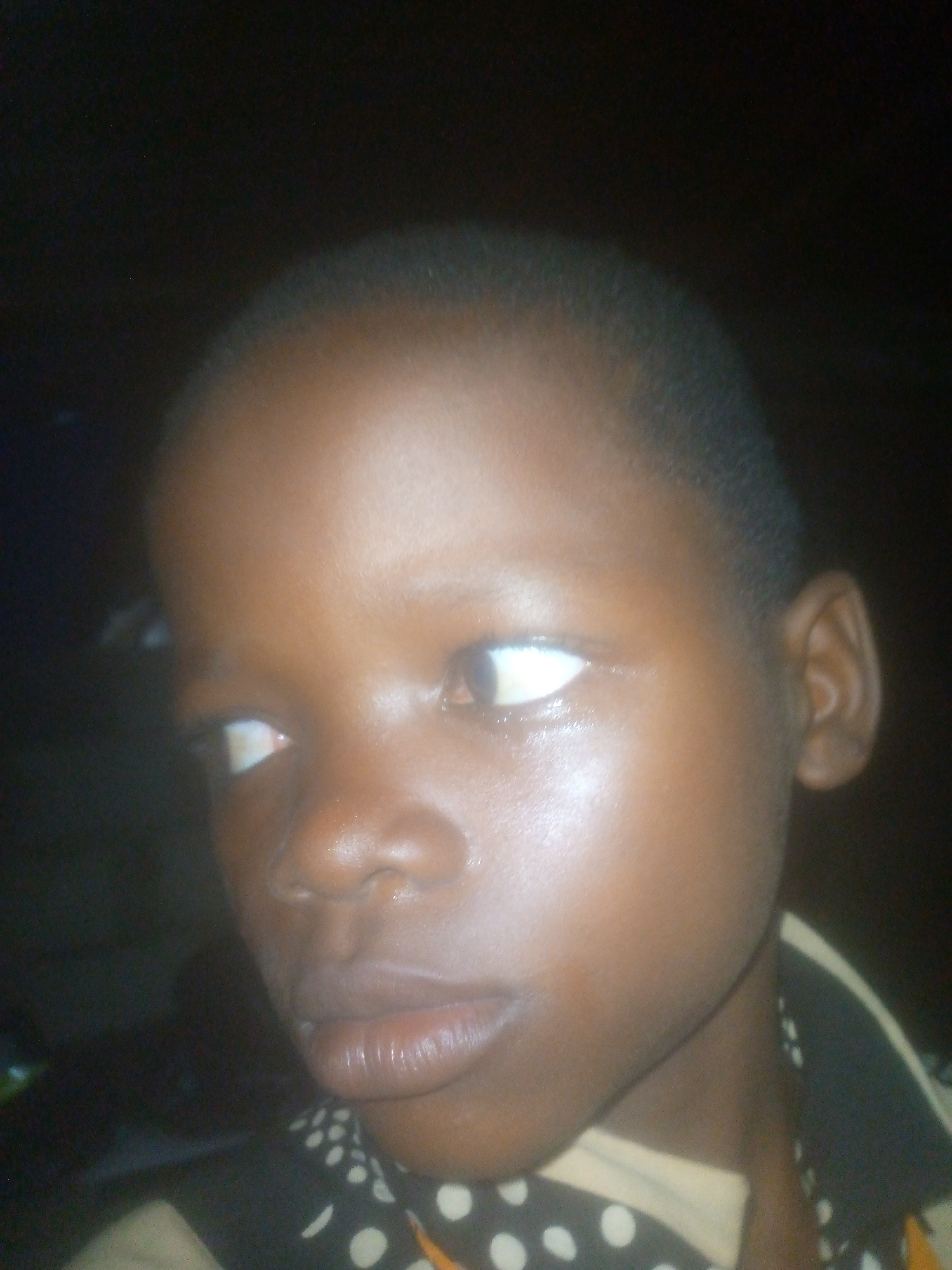 A close-up headshot of a young, dark-skinned child with a shaved head. The child's eyes are visible, and they are looking to the left. The lighting is uneven, and the background is dark. The child is wearing a dark shirt with white polka dots. The location and city are unknown.