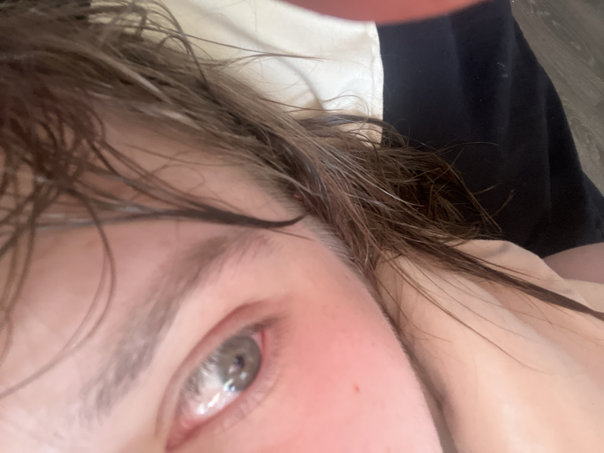 This is a close-up, vertically oriented image depicting a portion of a human face in the city of Saint Petersburg, Russia. The subject's light-colored eye, possibly blue or grey, is visible in the upper right quadrant, reflecting a light source in the pupil. The skin surrounding the eye exhibits a reddish tone, and the sclera appears pinkish, particularly near the tear duct. A faint red speck is present on the skin above the eye. Dark brown, disheveled hair, appearing somewhat damp, covers the left and lower sections of the frame, partially obscuring the forehead and cheek area. Below the visible eye, a light brown eyebrow is partially visible. A dark fabric, possibly black clothing, is visible in the upper left, while a light-colored, possibly cream or off-white, fabric is present along the bottom and lower-left edges, likely bedding or a pillowcase.