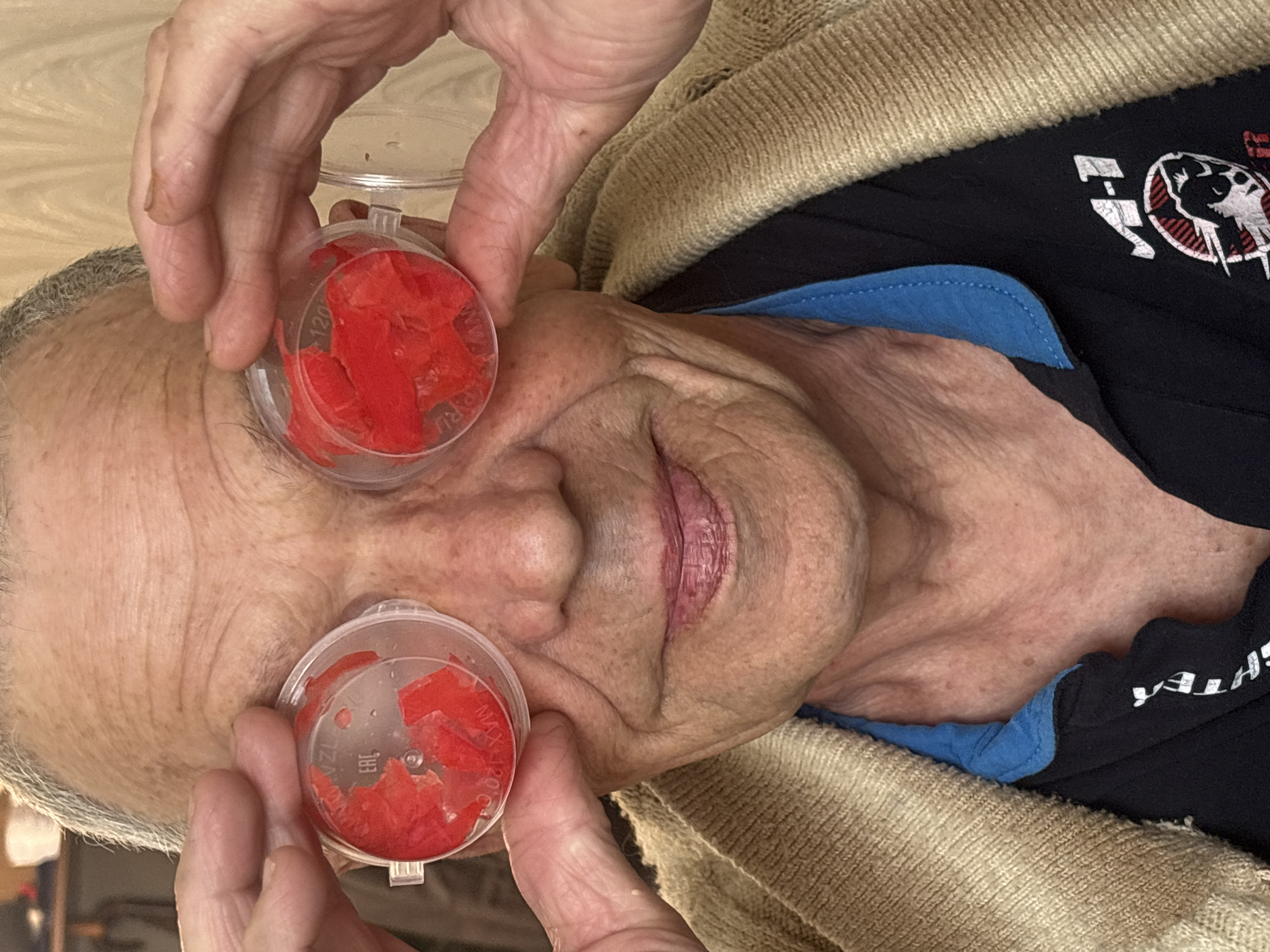 An elderly person is lying down, and two clear plastic containers filled with small, red, irregularly-shaped pieces are being held up to their eyes. The person is wearing a blue-collared shirt under a dark-colored t-shirt with white text and a logo depicting a raised fist. A beige sweater or blanket is around their neck. The background appears to be an indoor environment with a light-colored wooden surface. The location is not discernible from the provided image, so it's impossible to confirm if this image was taken in the city of Chaikovsky, Russia.