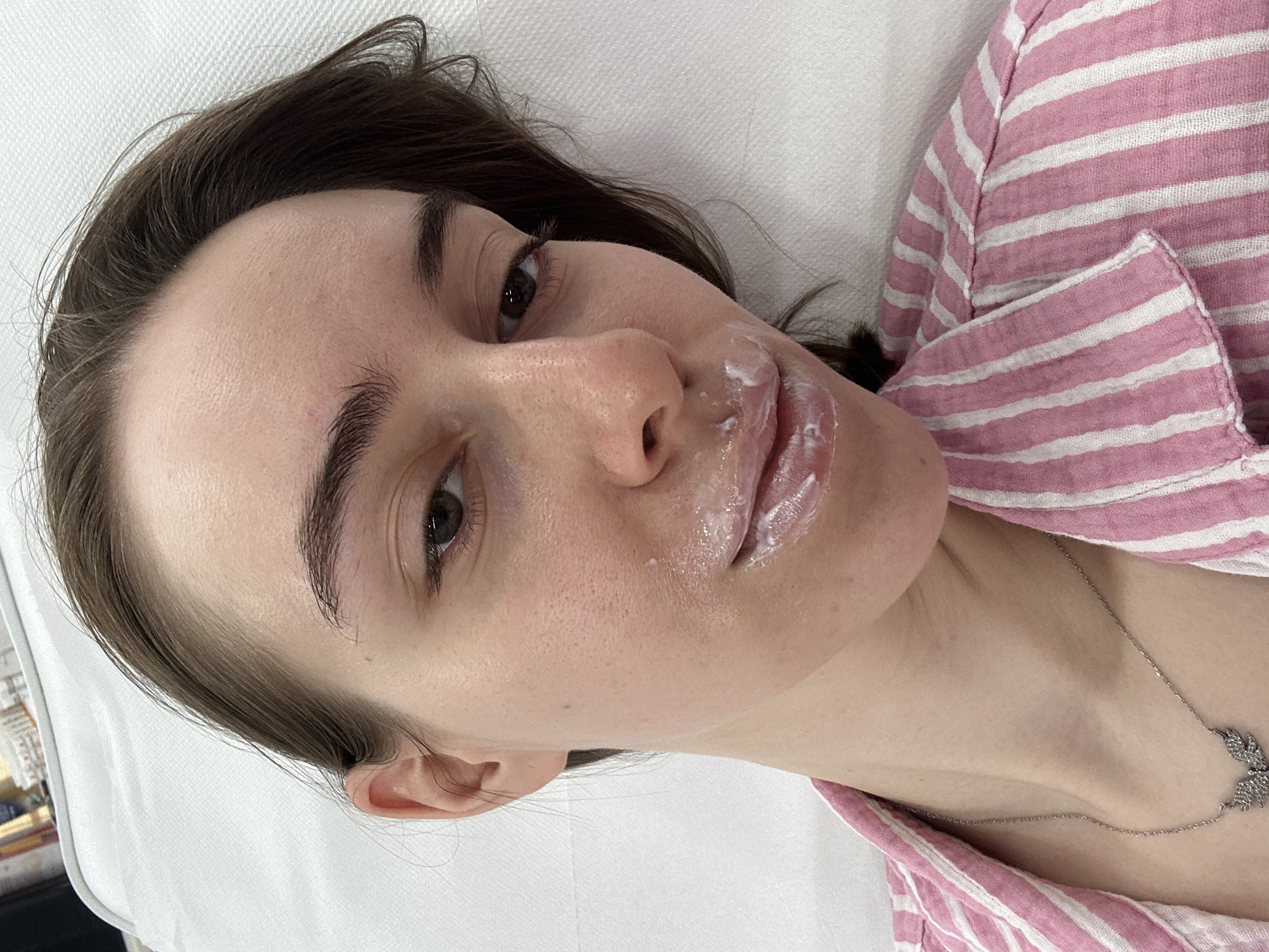 A young woman with dark brown hair lies on a white surface, possibly a bed or treatment table. She is wearing a pink and white striped shirt. A white, creamy substance is applied to her lips and around her mouth. Her right eye is partially visible, and she appears to be looking towards the camera. The lighting suggests an indoor setting. There is a faint, possibly beaded, silver necklace visible around her neck. The scene is a close-up shot of her face and upper torso.