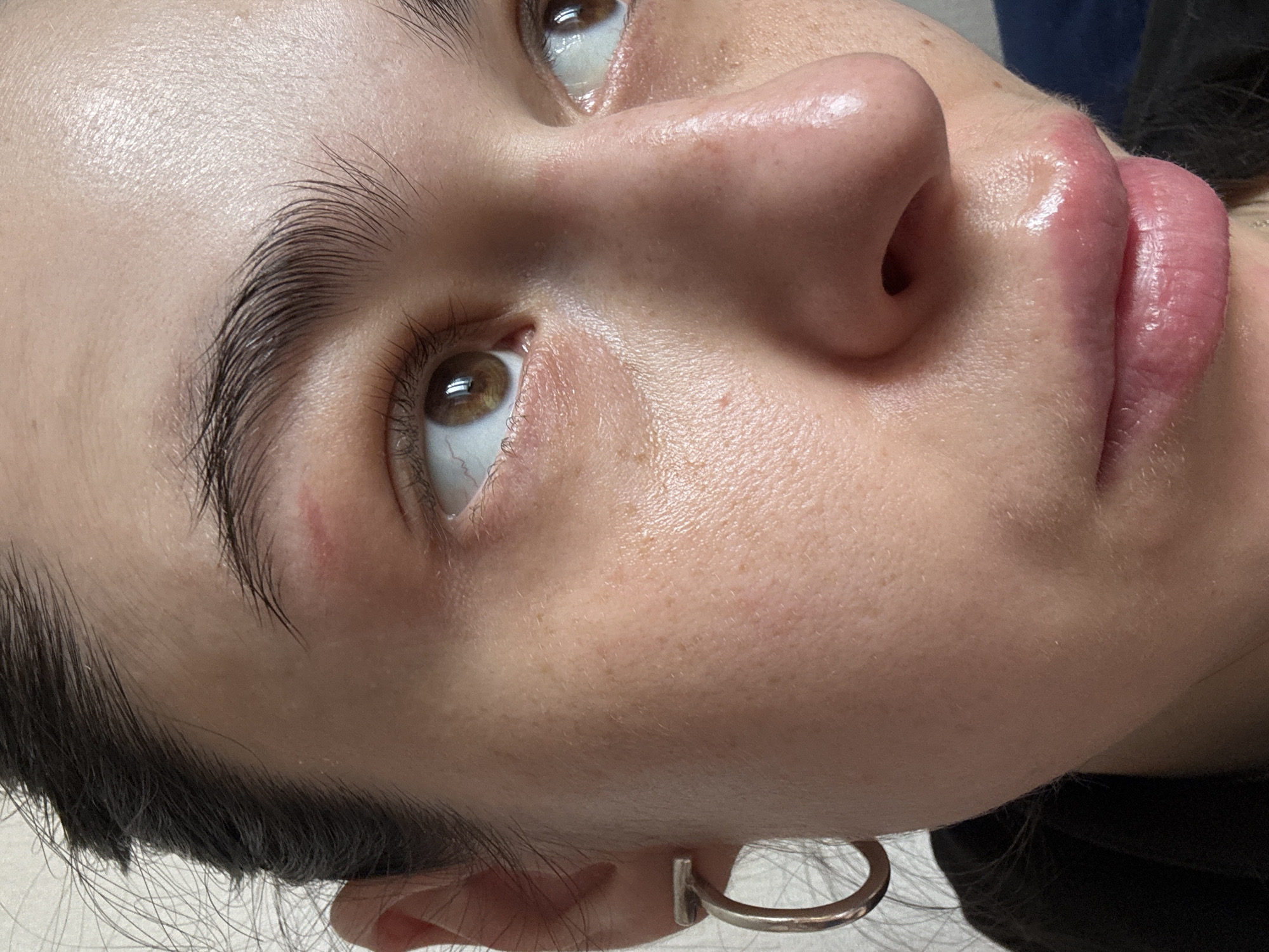 A close-up portrait shows the left side of a person's face, tilted and looking upwards. The dominant features are a brown eye, a sculpted eyebrow, the bridge of the nose, and the upper lip. The person has fair skin with a natural sheen, highlighting visible pores and a few freckles.
The left eye is open, revealing a clear brown iris and the white sclera, which shows a slight reddish tint in the lower inner corner. The eyebrow is dark, thick, and well-defined, with individual hairs brushed upwards. Just above the inner corner of the eye, a faint reddish mark or blemish is visible on the skin.
The nose bridge is smooth, and the tip and nostril are partially visible. The upper lip is full and appears somewhat swollen or augmented, with a glossy, natural pink color. The lower lip is mostly out of frame. A silver-colored hoop earring is seen in the person's earlobe on the lower right of the image. Dark hair frames the face near the ear and lower cheek. The background is out of focus, providing no specific environmental details, but suggests an indoor setting. There is no visible text. The image does not provide specific cues for the given location context of Saint Petersburg, Russia.