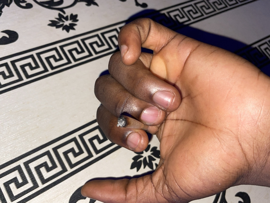 A dark-skinned hand holds a lit cigarette or joint between the index and middle finger. The hand is resting on a surface with a black and white geometric pattern, interspersed with floral designs. The cigarette's tip is visible and appears to be burning, with white ash at the end. The overall lighting of the image is dim.