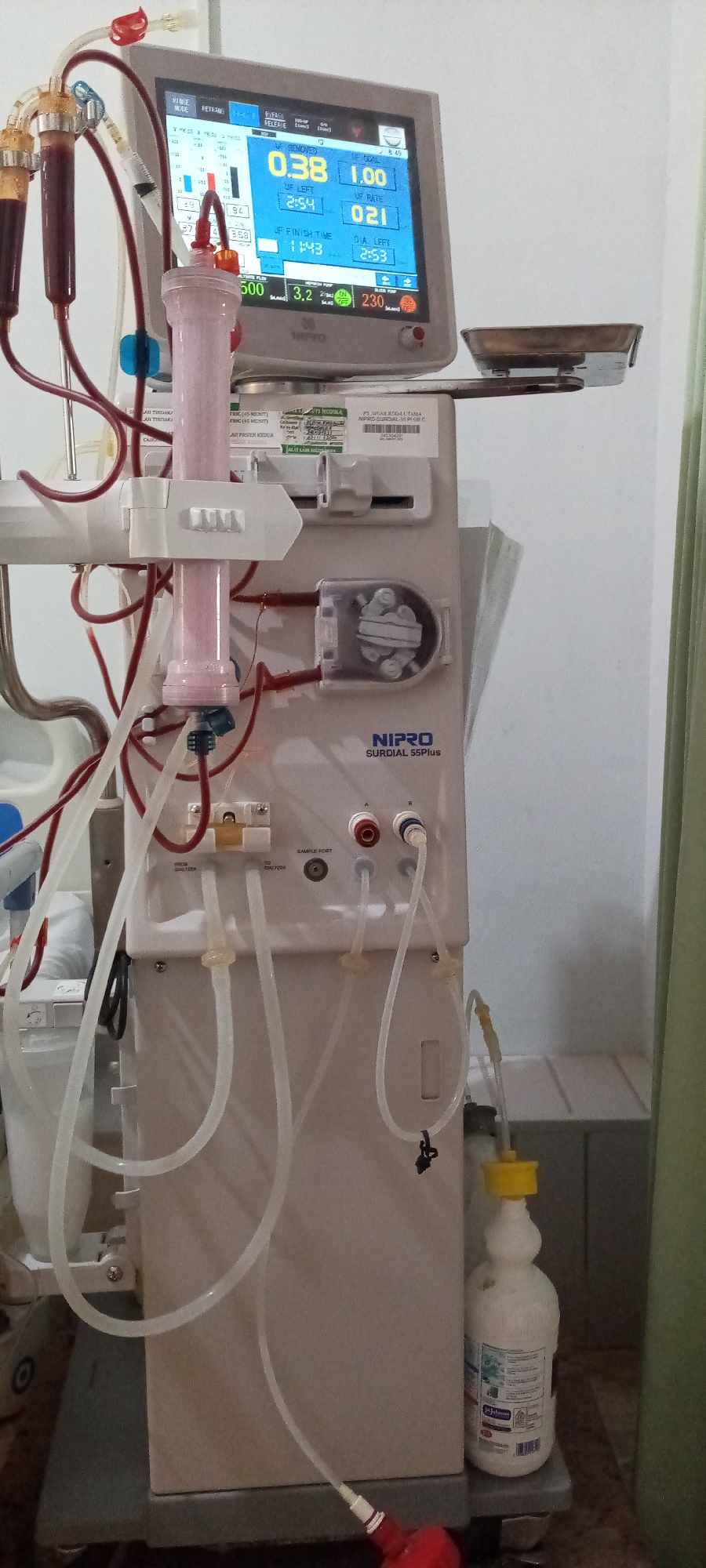 This image depicts a Nipro Surdial 55 Plus dialysis machine. The machine's display shows a UF Removed value of 0.38, a UF Goal of 1.00, UF Left of 2:54, UF Rate of 021, UF Finish Time of 11:43, and Dia Left of 2:53. Various tubes and filters are attached to the machine. A bottle is placed at the base. The location is Lhokseumawe, Indonesia.