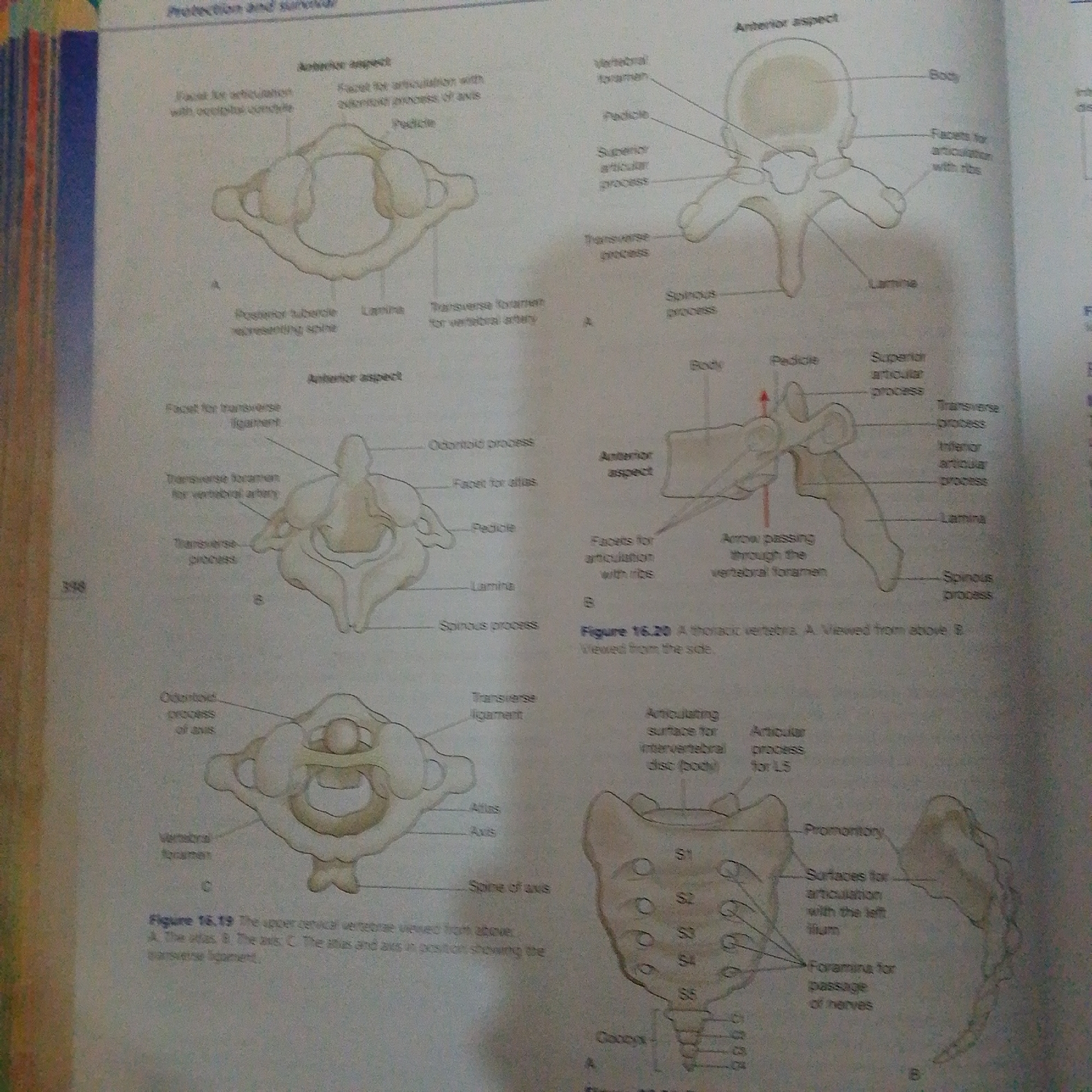 The image displays anatomical diagrams of vertebrae. It includes illustrations of a cervical vertebra (atlas and axis), a thoracic vertebra, and the sacrum and coccyx. The diagrams are labeled with anatomical terms such as "body," "pedicle," "lamina," "spinous process," "transverse process," and "articular facets." The overall presentation suggests an educational context, likely from a textbook or similar publication. The background is a plain, light-colored surface. There is no discernible connection to Jalingo, Nigeria.