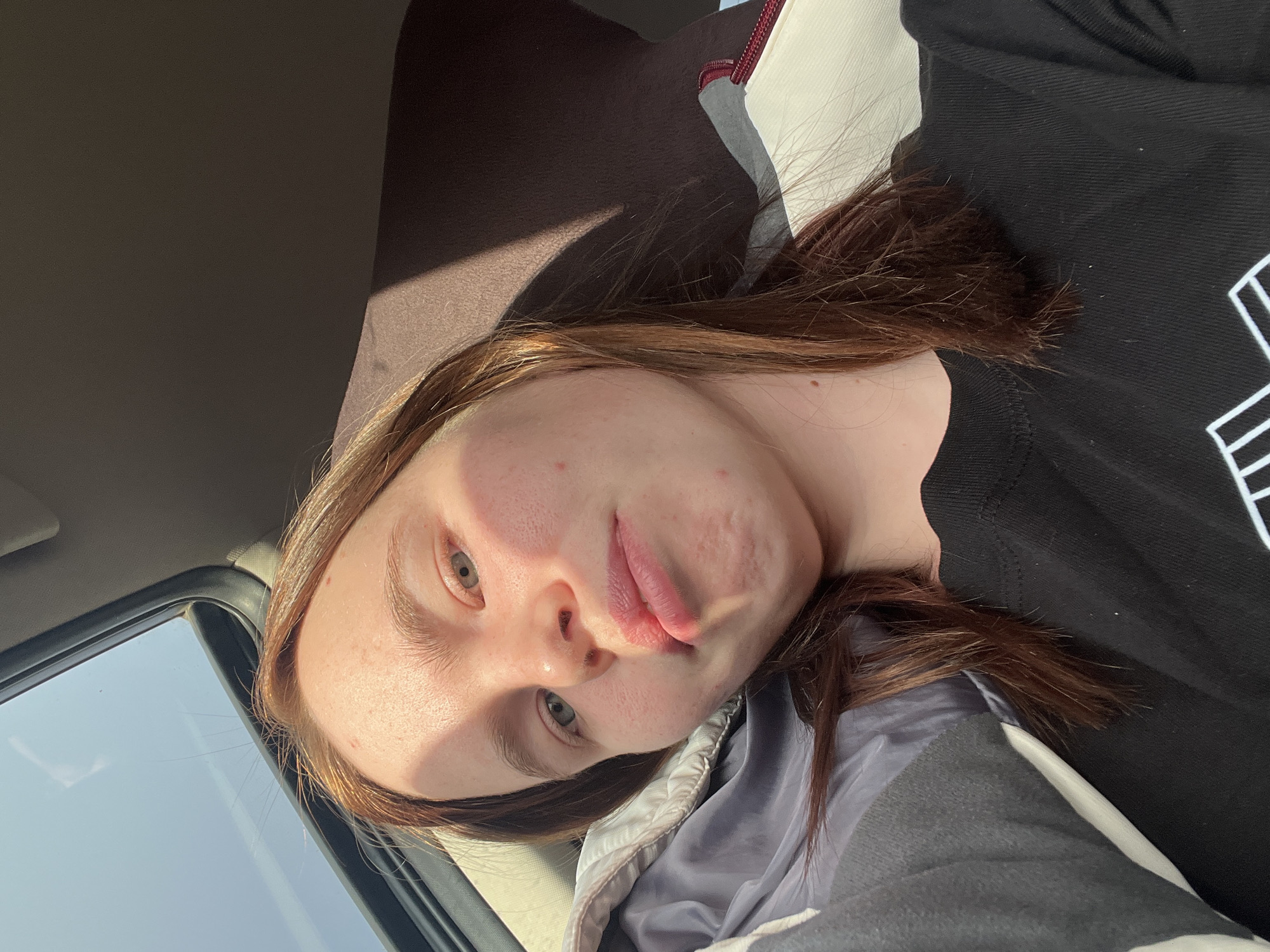 A close-up portrait shows a young person with fair skin, light-colored eyes, and light brown hair. They are positioned inside what appears to be a vehicle, likely a car, with a dark headliner and a window frame visible. The individual is wearing a black long-sleeved top with a partially visible white geometric graphic and a grey or light blue quilted jacket.
The person's head is tilted, and they are looking directly towards the camera with a neutral expression, their lips slightly pursed or pouting. Bright, direct sunlight streams into the vehicle from the upper left, casting strong shadows across parts of their face, notably on the forehead and cheek, suggesting a sunny daytime. Through the car window, a clear blue sky is visible. No discernible text is present on the visible graphic. While the location context is Kazan, Russia, no specific visual elements within the image confirm this.