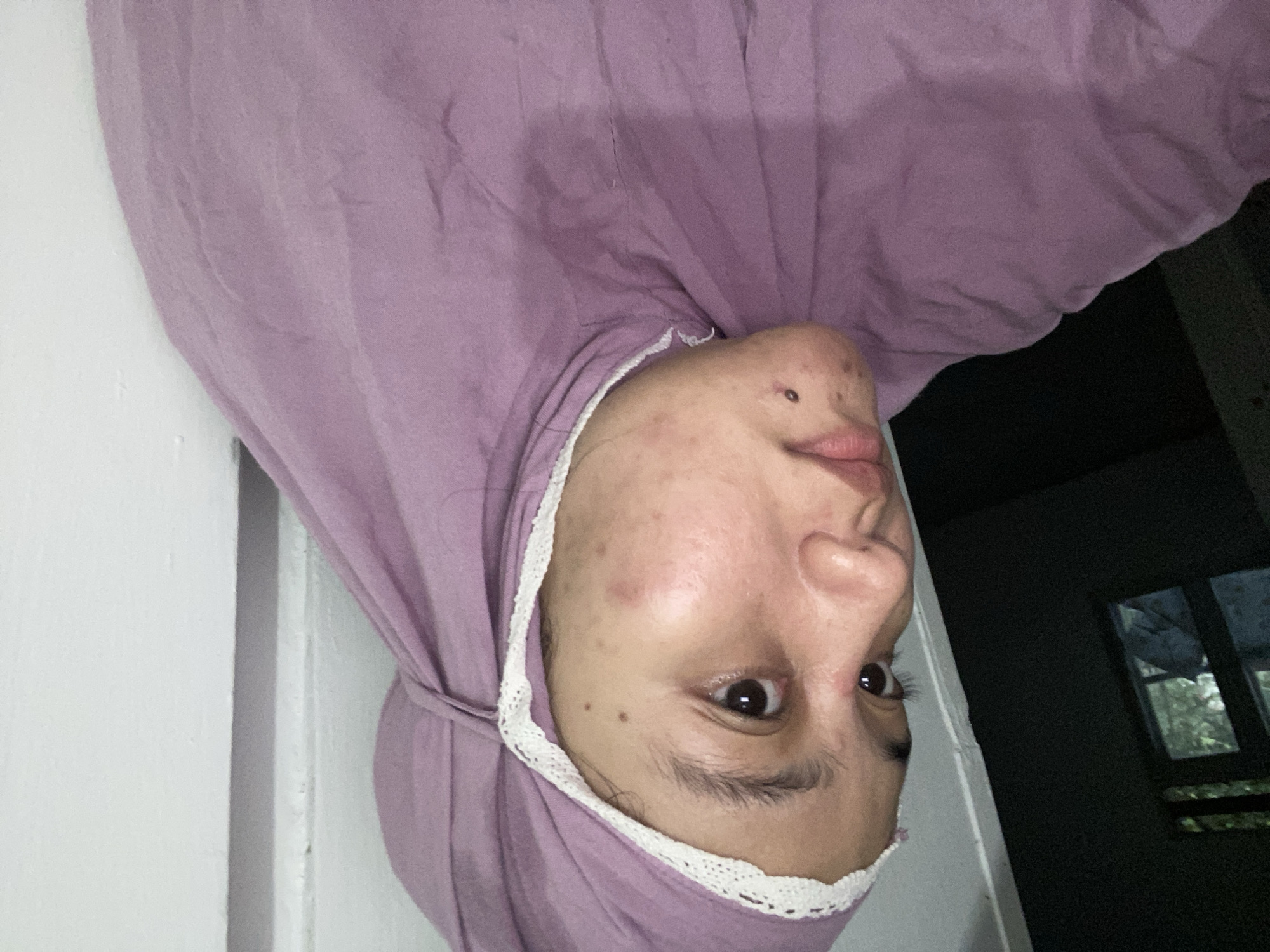 A close-up, profile shot shows a person wearing a purple hijab with a white lace trim, facing left. The person's face is visible, with acne and some skin imperfections. In the background, to the left, a dark room contains a window with greenery visible outside. To the right, a plain white wall is present. The lighting is dim, with the primary light source appearing to be from the right. The image was likely taken indoors. This scene is not identifiable as being in Banjarbaru, Indonesia.