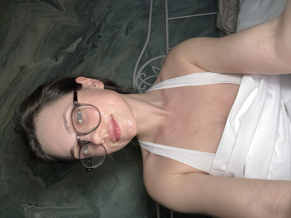 This image captures a close-up of a female subject in an indoor bedroom setting located in Scafati, Italy. The subject, of fair complexion, appears to be an adult, positioned centrally and looking directly into the camera. She has dark hair, light-colored eyes, and wears round, clear-framed prescription glasses. Her lips are full and exhibit a reddish tint, with a small, localized mark present on the upper lip, slightly right of center. She is wearing a white halter-neck garment and is partially covered from the chest down by white bedding or fabric. Behind the subject, a section of a white, ornate metal bed headboard is visible to the right. The wall forming the background features a distinct dark green marbled pattern, characterized by swirling, abstract lines. The scene is illuminated by soft, even lighting.