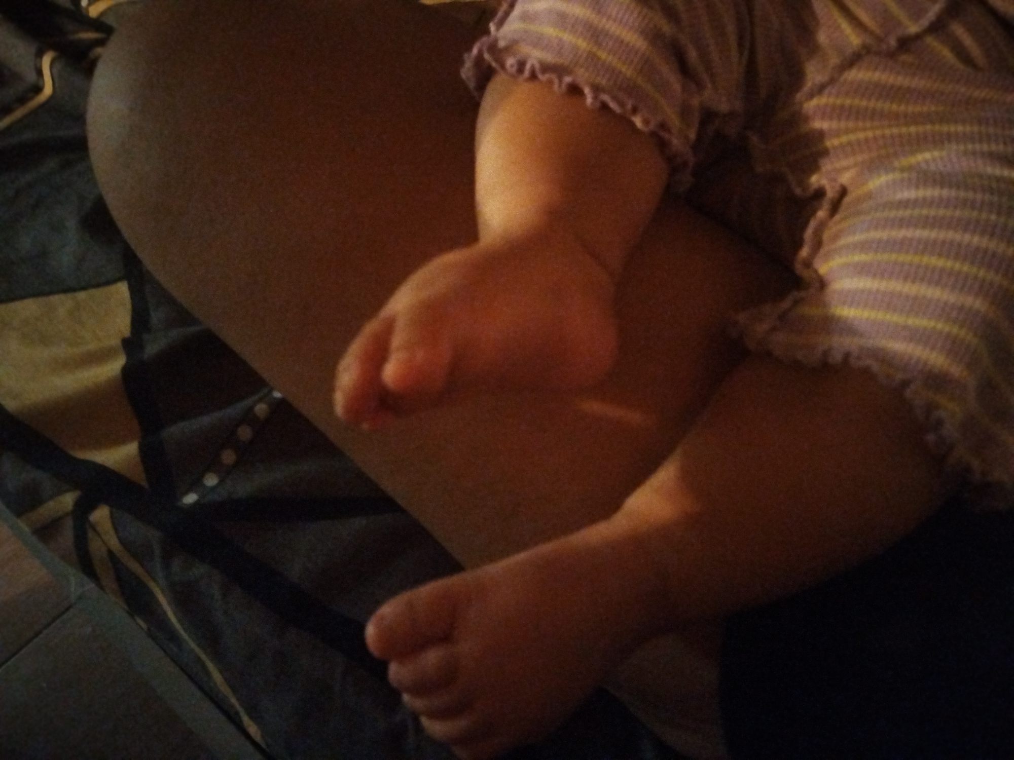 The image displays a close-up of a baby's foot and leg. The baby is wearing a striped shirt with purple and yellow stripes. The background consists of dark fabric. There is no discernible city or location information present in the image.