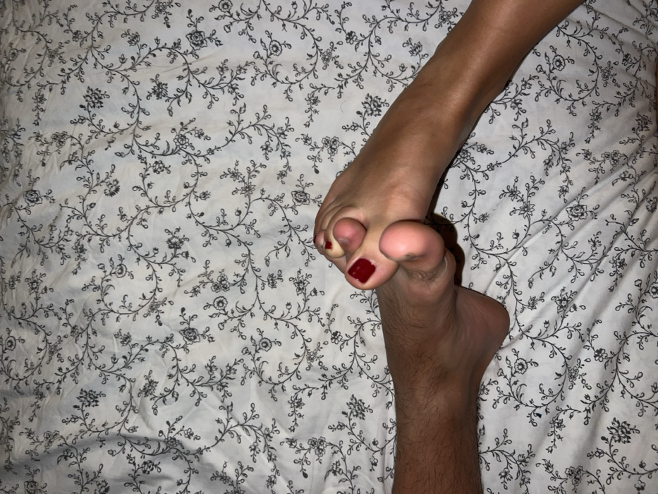 The image shows two sets of feet on a patterned bedsheet. The feet in the upper portion have painted red toenails, and the skin is lighter in tone. The second set of feet in the lower portion has darker skin with noticeable hair growth on the leg. The bedsheet features a white background with a floral and vine pattern in gray. The composition provides a top-down view of the scene.