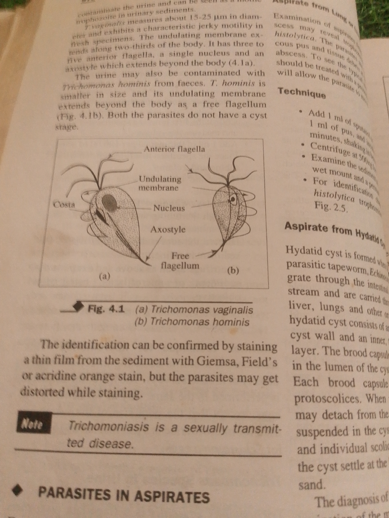 This media file shows a close-up of an open book, with text and diagrams. The text appears to be from a biology or medical textbook, discussing parasites and their identification. There are no people or identifiable objects beyond the book itself. The setting is indoor, likely a study area, as evidenced by the presence of printed material.
The content of the book discusses various types of parasites, including *Trichomonas vaginalis* and *Trichomonas hominis*, and methods for their identification through staining techniques. There is also a section on aspirating from hydatid cysts, which are formed by a parasitic tapeworm. The diagrams illustrate the morphology of the *Trichomonas* species.
Notable details include the title "PARASITES IN ASPIRATES" and the figure caption "Fig. 4.1 (a) Trichomonas vaginalis (b) Trichomonas hominis". Another section is titled "Note Trichomoniasis is a sexually transmitted disease." The overall tone of the text is informative and instructional. There are no cues regarding the time of day, weather, or specific emotions. The location context "Jalingo, Nigeria" is provided as metadata, but there are no visual elements within the image to confirm this location.