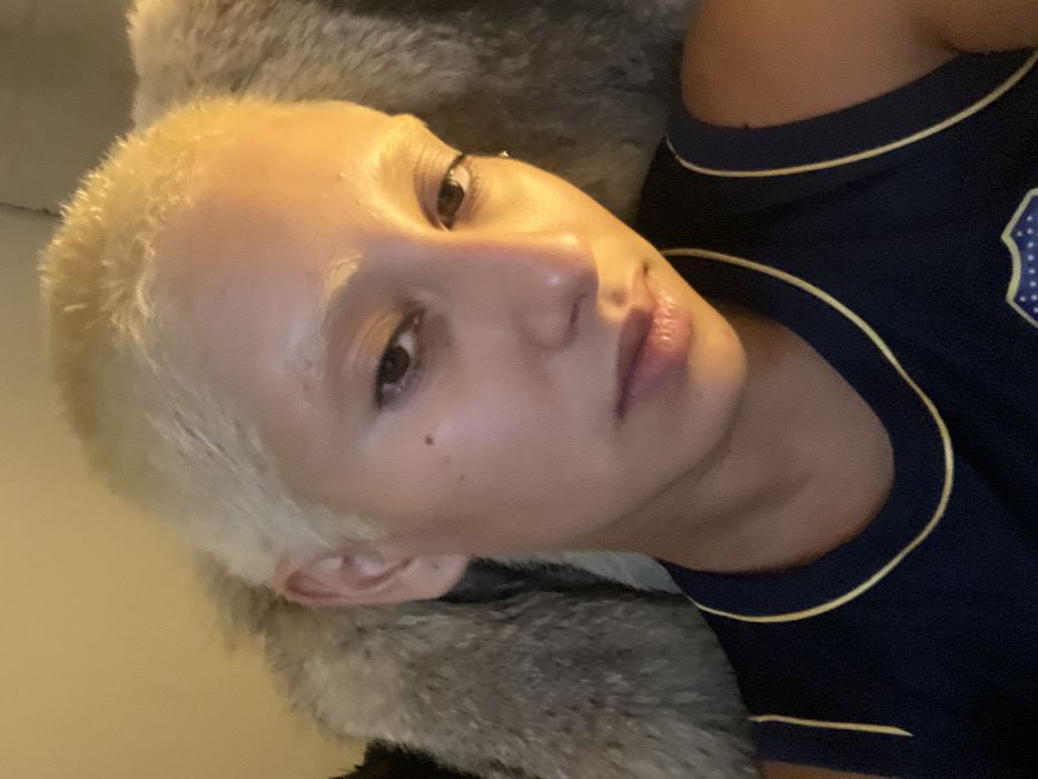 A single female subject is depicted in a medium-close-up shot, likely taken indoors. The subject has bleached blonde, very short hair, styled into two distinct, small, rounded forms protruding upwards from the sides of the head. Her eyebrows are also bleached blonde. A dark epidermal nevus is visible on the upper right cheek. Her eyes are dark brown, and her gaze is directed towards the camera. The subject's mouth is slightly ajar, with the lips appearing moisturized. She is attired in a dark blue, sleeveless garment featuring yellow trim around the neckline and armholes. A partial emblem, exhibiting a blue and yellow shield design consistent with the Boca Juniors football club, is present on the lower left quadrant of the garment. Behind the subject's head, a textured material, light brown-grey in coloration and exhibiting a fur-like or shaggy pile, is partially visible. The background is out of focus and illuminated by an ambient yellow light source. The garment's emblem culturally contextualizes the scene as being within or connected to Buenos Aires, Argentina.