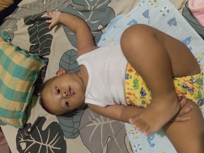 An infant with light brown complexion is depicted lying in a supine position on a bed. The subject wears a white sleeveless undershirt and yellow shorts adorned with various cartoon characters. The infant's left arm is extended upwards and outward, with the hand open. The right arm is bent, resting near the torso. Both legs are flexed, with the left foot positioned on the inner aspect of the right thigh. A light blue mat with white and blue patterns is situated beneath the lower half of the infant. The bed is covered with a sheet featuring a grey and green leaf pattern on a light background. A striped pillow, colored teal and golden yellow, is visible in the upper left background. The infant's head is slightly tilted, with eyes open and a neutral expression, and the mouth is slightly agape, revealing two lower incisors. The gaze is directed towards the viewer's left.
Location: Unknown residence in Unknown, Unknown.