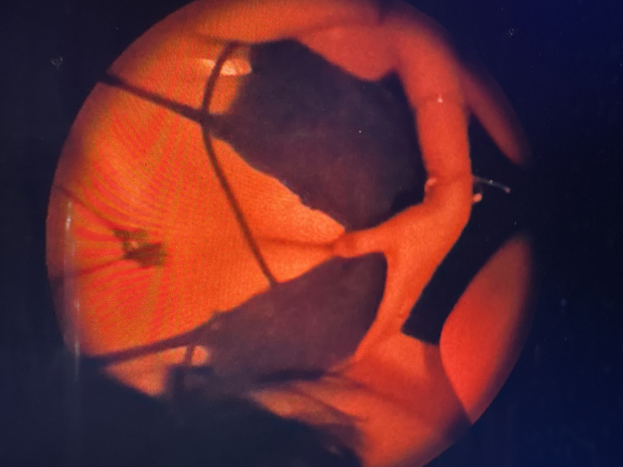 The image is a close-up, circular shot with a dark background, featuring a subject dressed in dark lingerie against an orange, textured surface. The lighting is dramatic, casting strong shadows and highlighting the curves of the subject's body. The overall impression is one of intimacy and sensuality.