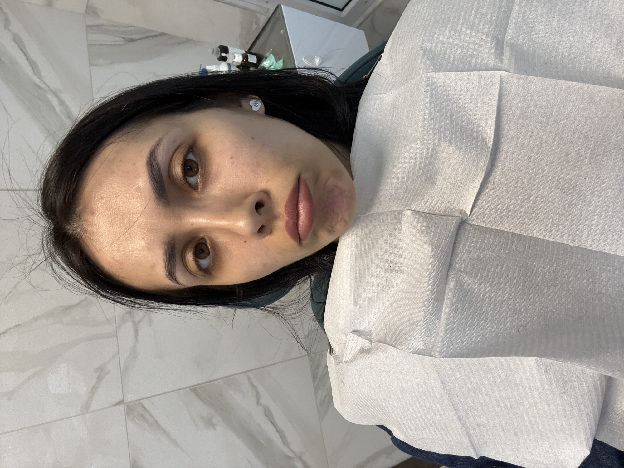 A woman with dark hair and brown eyes lies in what appears to be a dentist's or medical examination chair. She is draped in a white, disposable bib. The background includes white marble-like wall tiles and medical equipment on a white surface. The image location within Votkinsk, Russia, cannot be determined from this image.