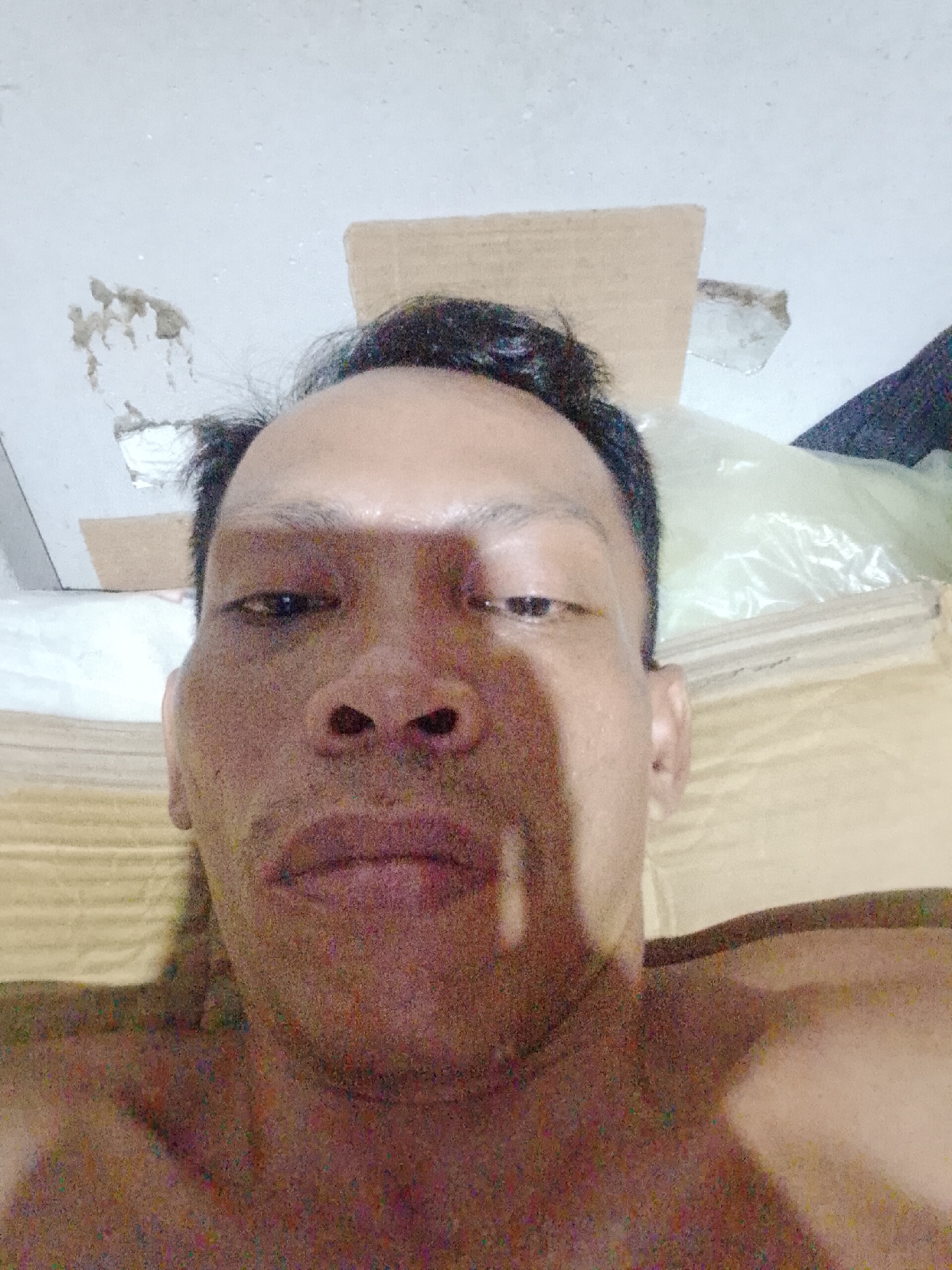 A close-up selfie of a middle-aged Asian man with short black hair. The man's face fills the majority of the frame. He is looking directly at the camera with a neutral expression. A shadow falls diagonally across his face from left to right.
Behind the man is a white surface that appears to be a ceiling. There are damaged areas on the ceiling, with pieces missing or peeling. Additionally, there are some cardboard pieces attached to the ceiling. A portion of a white plastic sheet is visible behind the man’s head to the right. The lower portion of the frame reveals the man's bare chest and shoulders.
Given the specific city location provided, it can be inferred that the image was taken in Bukit Ketok, Indonesia.