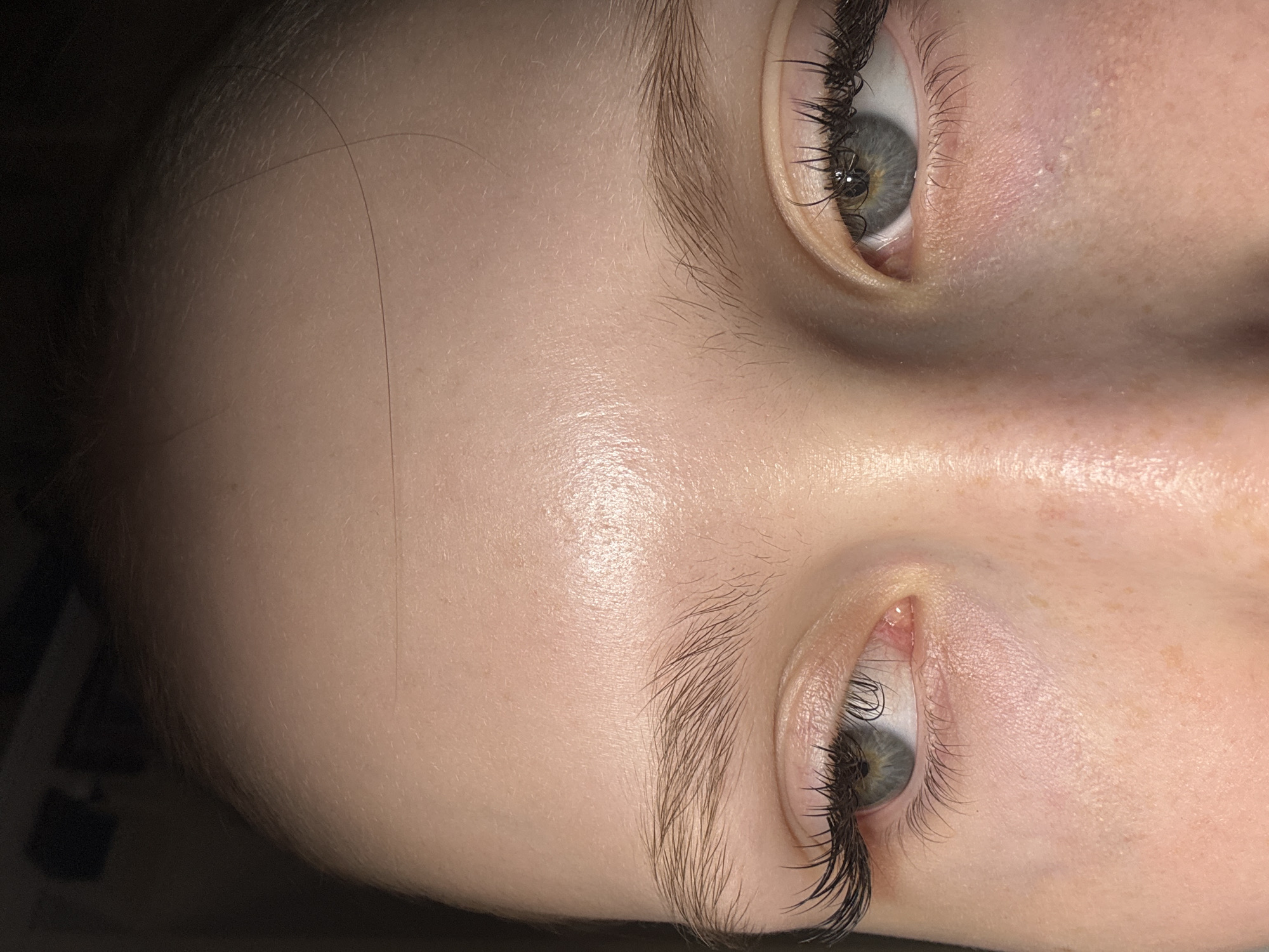 A close-up photograph, rotated to the left, shows a person's face from the forehead to the upper cheek area. The skin appears pale and smooth with visible pores and a slightly oily sheen. Two eyes are visible, one positioned in the upper right and the other in the lower left. They are light-colored, possibly grey or blue-green, with dark eyelashes. The eyebrows are full and well-defined. No specific location in Chaikovsky, Russia, can be discerned from the image. There is no discernible action or interaction occurring, and the environment is limited to the immediate area of the face.