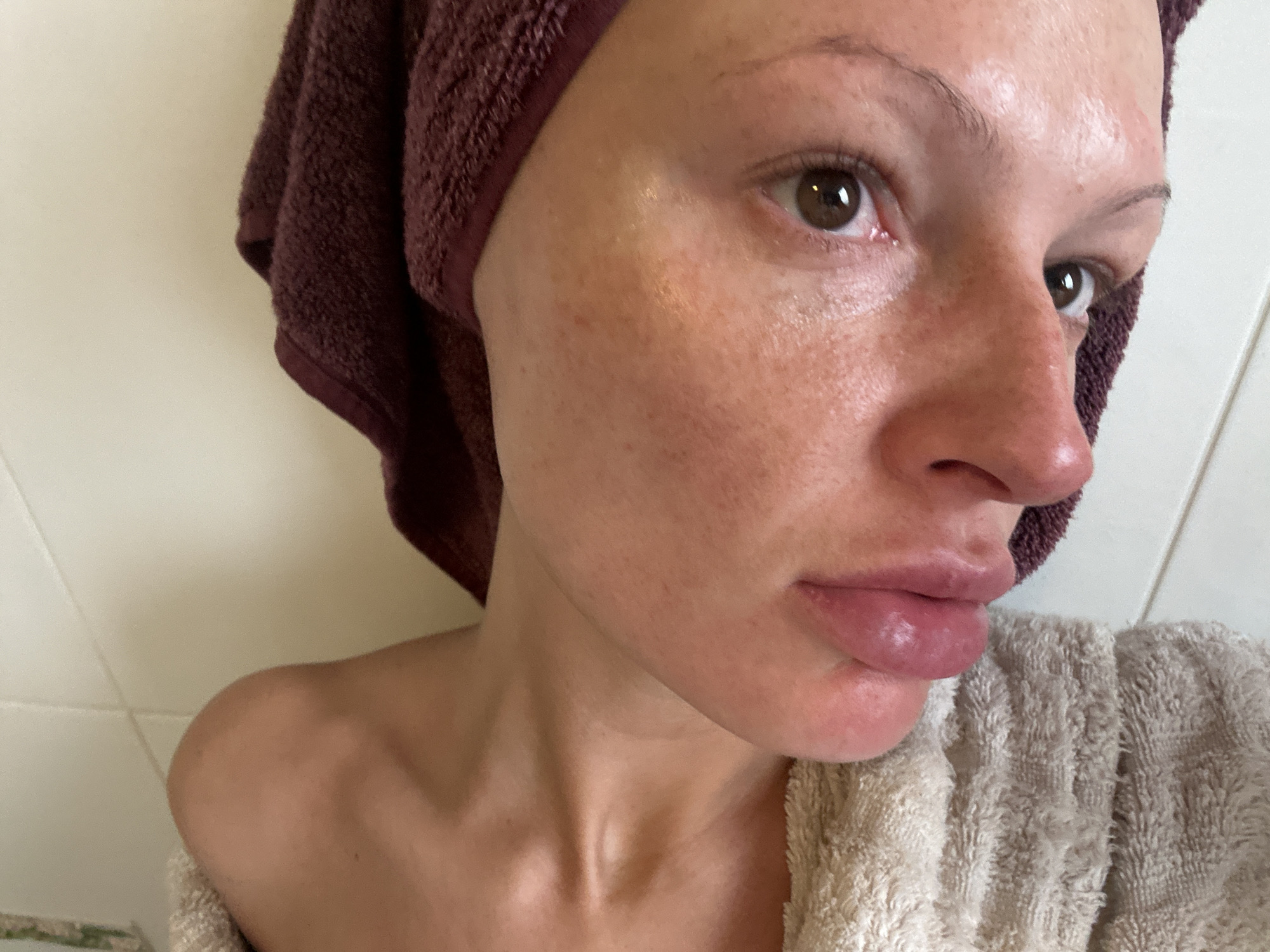 A close-up, well-lit photograph features a person with fair skin, freckles, and brown eyes. They are positioned indoors, potentially in a bathroom, as tiled walls are partially visible in the background. A maroon-colored towel is wrapped around their head. Another towel, off-white in color, is draped over their shoulder. The person's face shows signs of moisture or recent cleansing. The image's focus is primarily on the person's face, capturing details of their skin texture and features. Tunbridge Wells, United Kingdom is not apparent in this image.