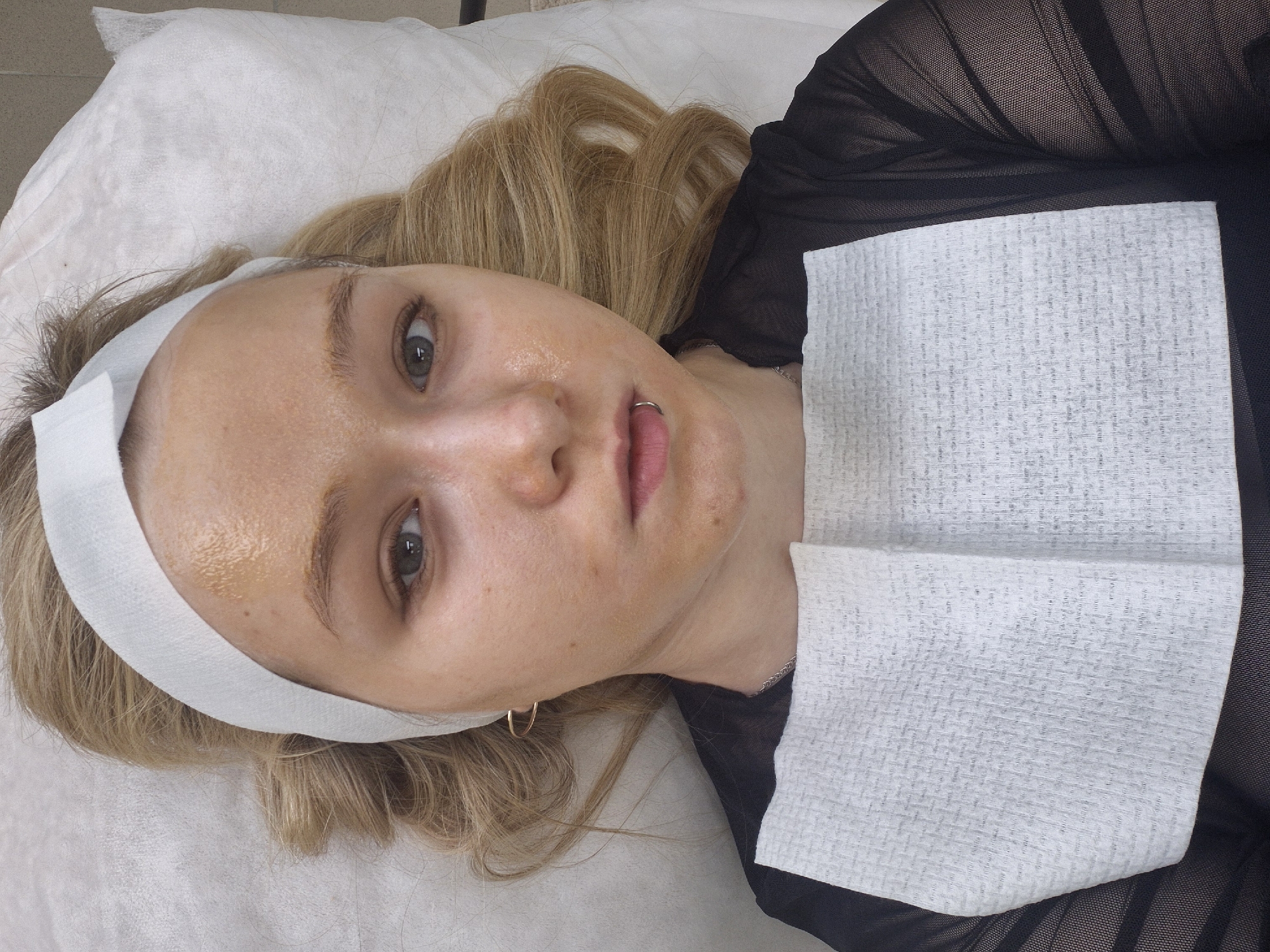 A woman with blonde hair is lying on a white surface, possibly a treatment table or bed. She is wearing a white headband and has a golden-colored substance applied to her face. A white, folded paper towel rests on her chest, over a black, sheer top. She has a piercing through her lower lip. She is wearing a gold hoop earring in her right ear. The scene appears to be indoors, likely at a beauty treatment facility or spa. Location: This image was likely taken in the city of Chaikovsky, Russia.