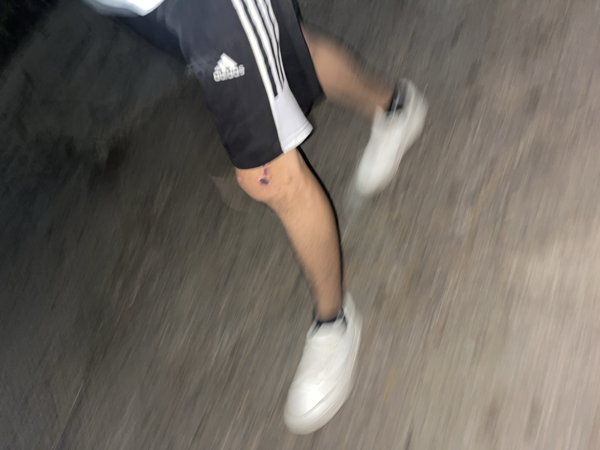 The image shows a close-up, blurred view of a person's lower body, specifically their right leg. The person is wearing black Adidas shorts with white stripes and white shoes. There is a visible abrasion or scrape on the person's right knee, appearing as a dark reddish-brown mark with some discoloration. The ground beneath the person appears to be a paved surface, possibly concrete or asphalt, with a textured, greyish-brown appearance. The lighting suggests it is either nighttime or a dimly lit environment, and the blur indicates movement. There is no discernible indication of the location being the city of Santa Ana, Venezuela.