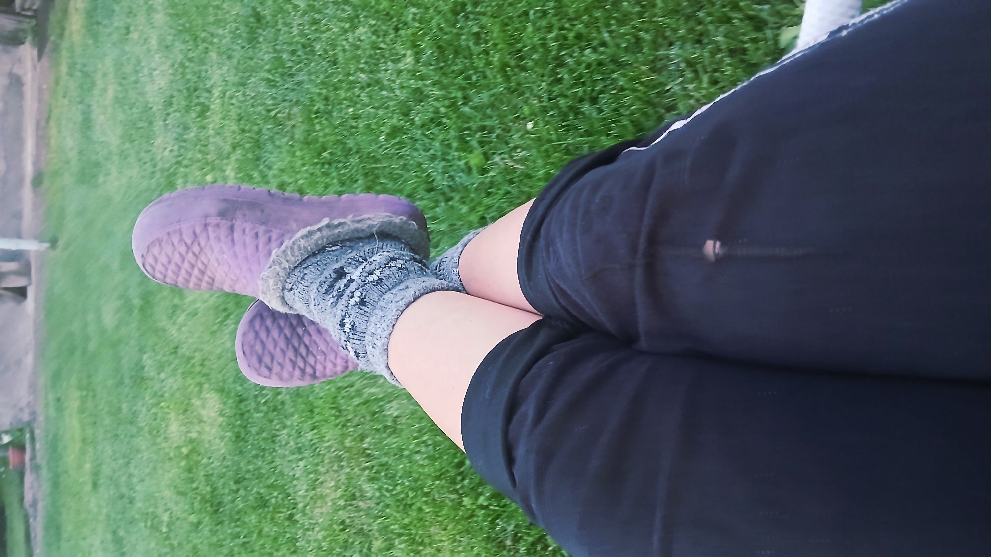 The image shows a close-up view of a person's legs from the knees down, resting on a green lawn. The person is wearing black shorts, gray patterned socks with fuzzy trim, and purple slip-on shoes. The shoes have a diamond-shaped tread pattern. The lawn appears to be well-maintained. There is a small tear in the right leg of the shorts, with a pinkish stain visible through it. In the background, a blurred view of what appears to be a yard with a potted plant and a fence can be seen, suggesting an outdoor setting. The image is taken from a slightly elevated angle, looking down at the legs. The scene is likely set in Nadezhdenka, Russia, as indicated.