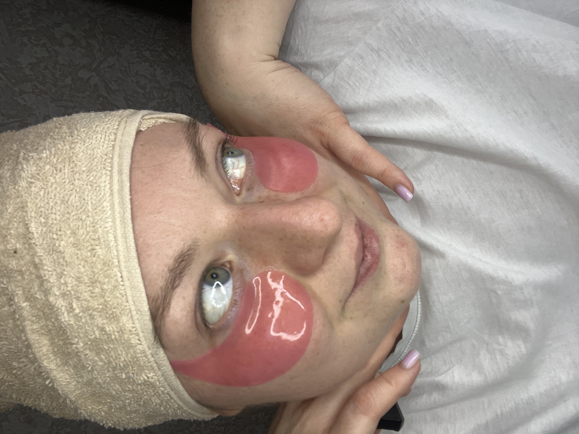 A woman with fair skin is lying on a white surface, likely a bed or examination table, wearing pink under-eye patches. She has a beige towel wrapped around her head. Her eyes are light-colored, and she has freckles on her face. One of her arms is raised near her head, with fingers visible. The background consists of a gray textured surface, and the woman's head is positioned at an angle to the camera. Based on the provided location, this scene is occurring in Раздолье, Russia, though there are no visual elements directly linking the scene to that specific city.