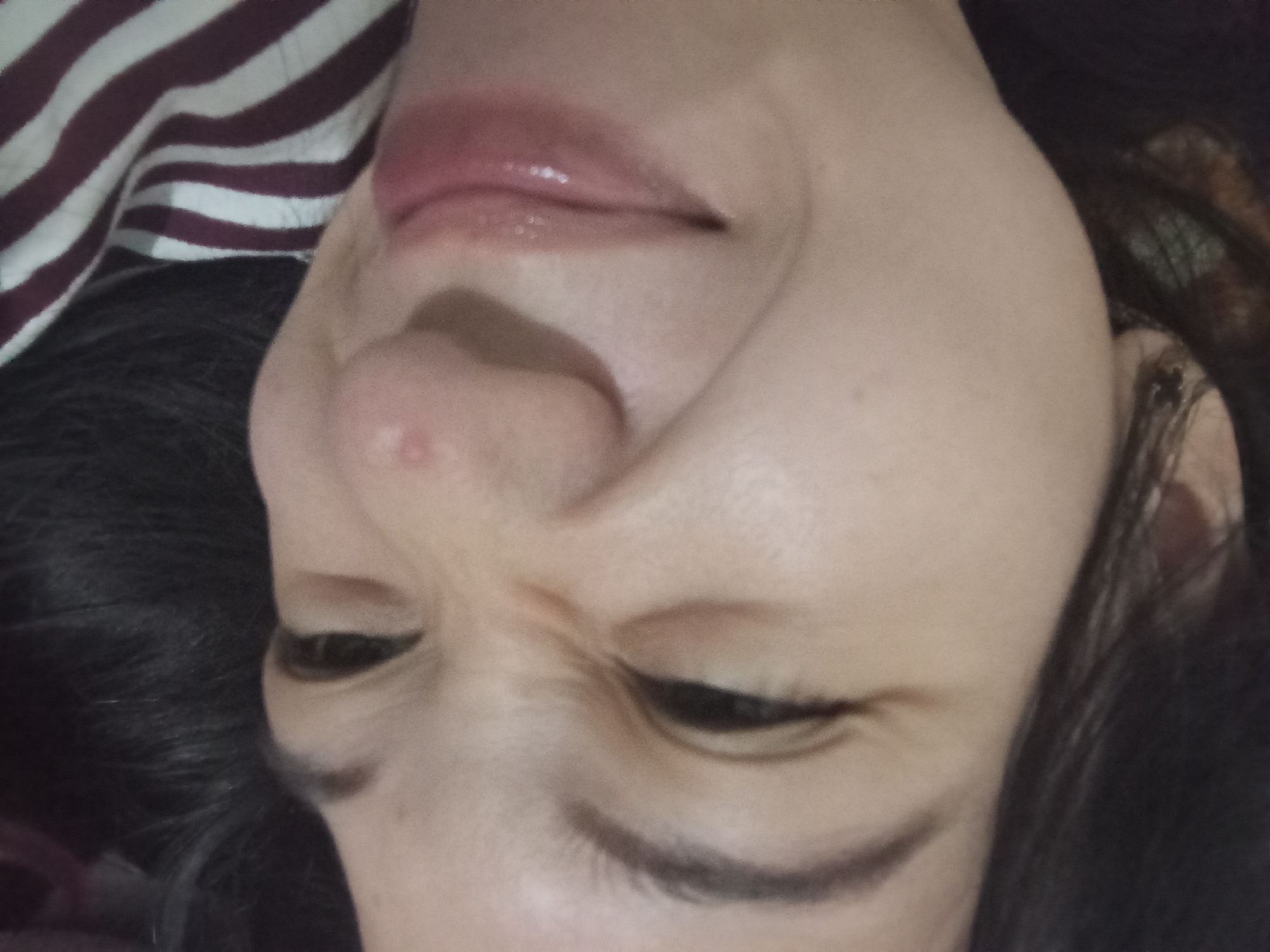 The image is a close-up, Dutch-angled, poorly lit, and out-of-focus photograph of a person's face, specifically focusing on their nose, mouth, and eye area. The skin tone appears to be fair. There is a small red pimple visible on the person's nose. The person's lips are slightly parted and appear glossy. Dark hair is visible around the edges of the frame, and a striped fabric, possibly a shirt or blanket, is visible in the lower left corner. There is no information in the image to suggest a location in Rejosari, Indonesia.