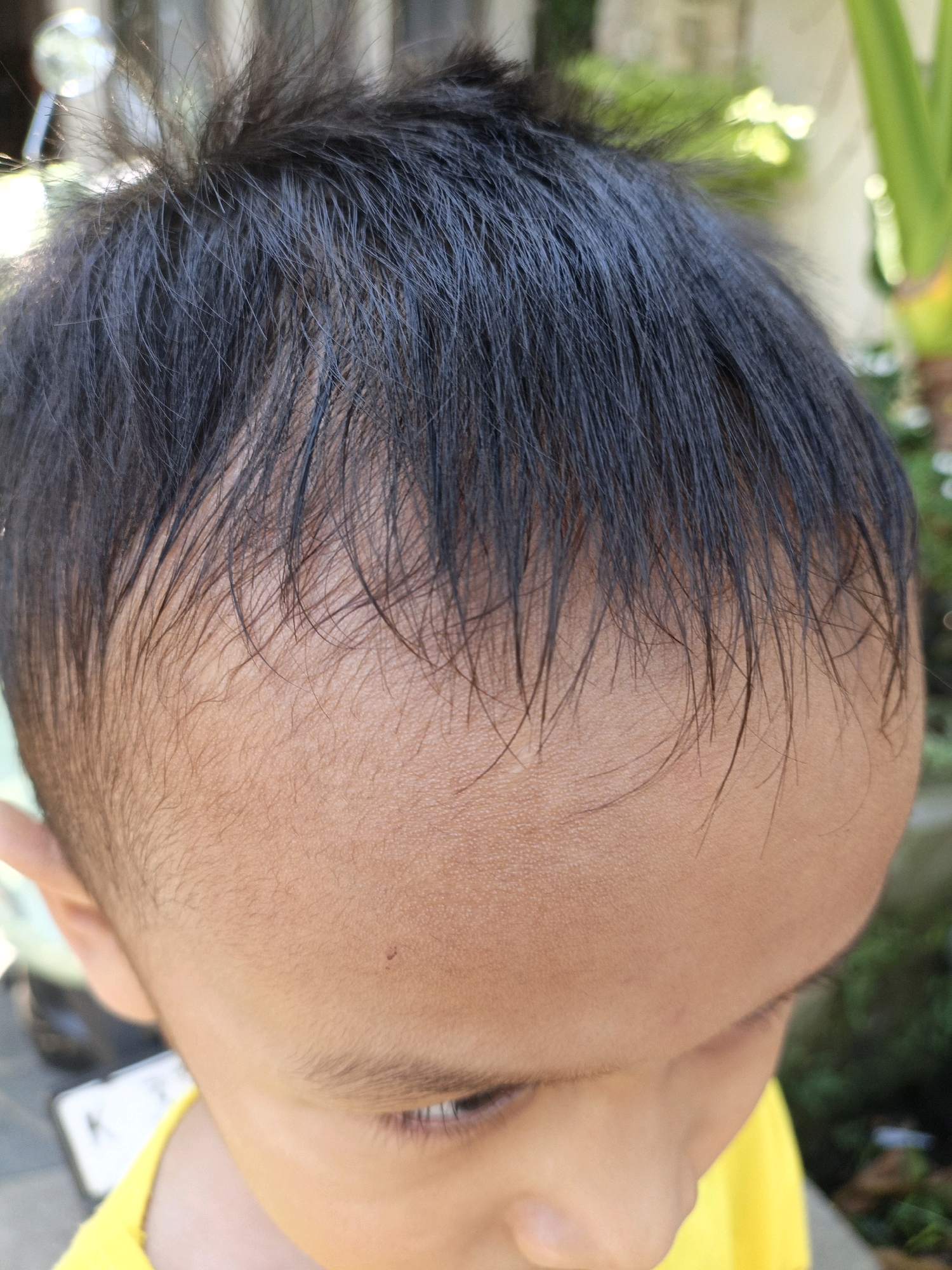 This is a close-up, over-the-shoulder shot of the top of a child's head and forehead. The child has dark, somewhat messy hair and is looking down. A small, dark mole is visible on the child's forehead. The child is wearing a bright yellow shirt. The background is softly blurred, showing some greenery and possibly a light-colored object that might be part of a building or a sign. The lighting suggests an outdoor setting, possibly in daylight. There is no indication of the location within the city of Cikal, Indonesia.