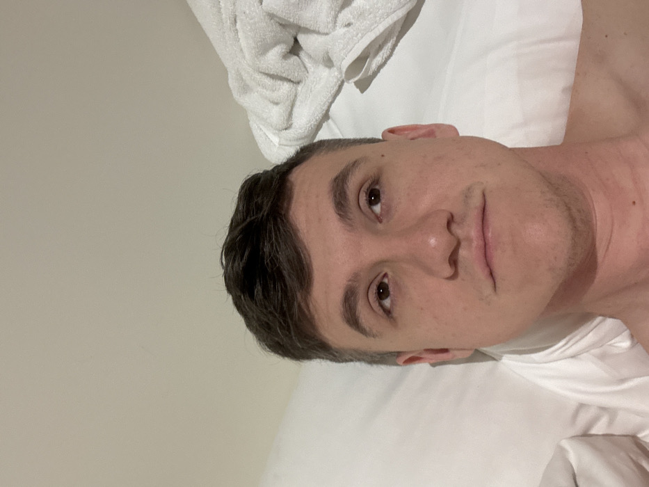 A close-up, high-angle shot depicts a light-skinned adult male lying on a bed in an indoor setting. He has short, dark brown hair and brown eyes, with light stubble visible on his upper lip and chin. His expression is neutral as he gazes upwards and slightly to the right. He is shirtless, with his upper chest visible above white bed sheets and a white pillow positioned to his left. A crumpled white terry cloth towel is visible on the right side of the frame, resting on the bed. The background consists of a plain, light-colored wall. The scene is located in the city of Venice, Italy.