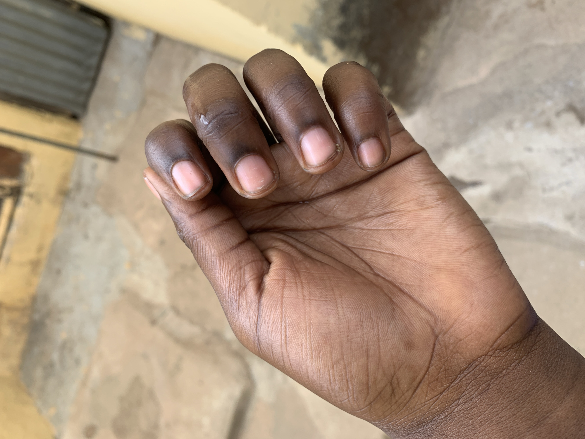 The image shows a dark-skinned human hand with short, unpolished nails. The background appears to be an outdoor setting, possibly a courtyard or sidewalk in Rafin Par, Nigeria, with concrete or paved surfaces visible. The hand is in a relaxed position, with a slight curl of the fingers. There's a possible water droplet on one finger. There are no other people or objects immediately discernible in the image.