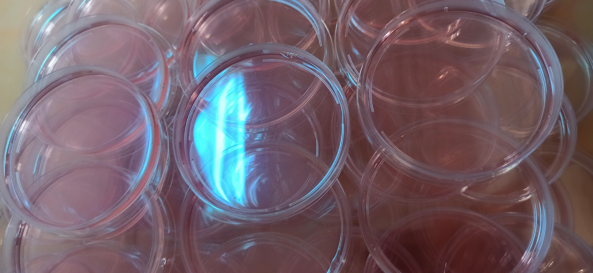 The image shows a close-up, overhead view of a large pile of clear, round, plastic petri dishes. They are stacked on top of each other, with some of the dishes slightly angled, creating an overlapping pattern. The lighting in the image is dramatic, casting reflections and highlights across the surfaces of the dishes. One particularly bright, vertical reflection of blue light is prominent in the center of the image, suggesting a strong light source. The petri dishes appear to be disposable and are commonly used in laboratories for culturing microorganisms. The overall impression is one of a large quantity of laboratory supplies, possibly in storage or awaiting use. There is no visible text in the image, and no indication of people, specific weather conditions, or time of day. The setting is likely a laboratory or a storage area within a scientific facility. The image is abstract in nature, focusing on the textures, shapes, and light reflections of the objects themselves rather than a narrative scene.