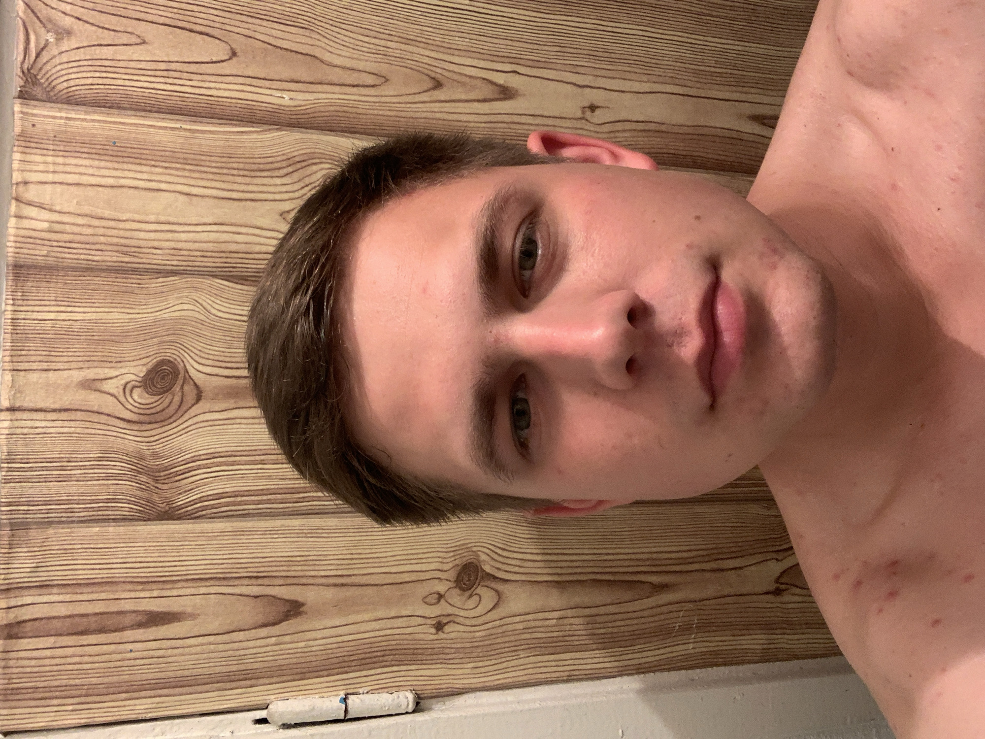 A portrait photograph shows the head and upper torso of a young Caucasian male against a wood-paneled wall. The man is facing forward, looking directly at the camera. He has short, dark brown hair, fair skin, and light-colored eyes. His expression is neutral. He is shirtless, revealing some red blemishes on his chest and shoulder. The wood paneling behind him has a vertical grain pattern and features knots. To the left of the frame, a white doorjamb with a hinge is partially visible. The lighting appears to be warm and direct, casting subtle shadows on his face. The overall setting seems to be indoors, possibly a bathroom or bedroom, given the wood paneling and doorjamb. The location is unknown.