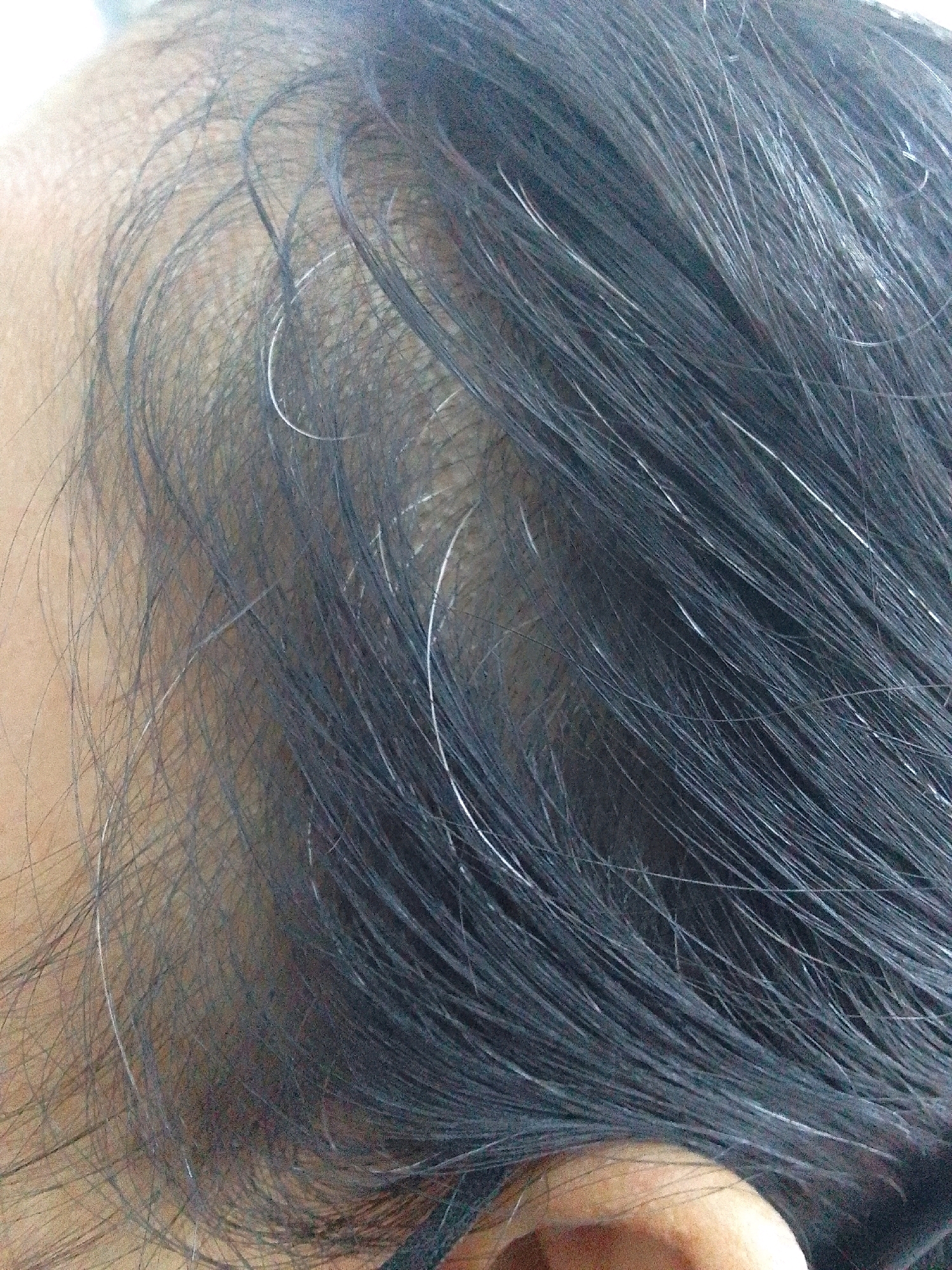 The image is a close-up, slightly blurry, overhead shot of a person's scalp and hair, with some white hairs interspersed with dark hair. The skin tone appears to be medium to dark. The lighting suggests an indoor environment. The scene is not identifiable as being in Tambaksogra, Indonesia or any other specific geographical location.