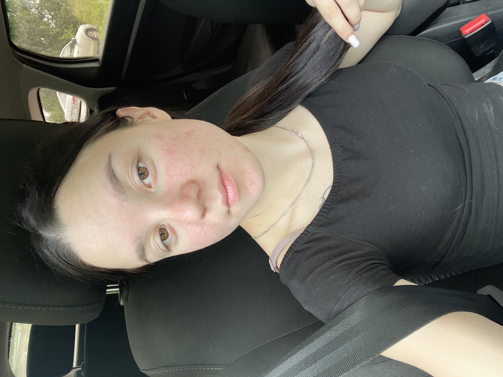 A young woman with brown hair and brown eyes is sitting in the driver's seat of a car. She is wearing a black t-shirt and a silver necklace. Her skin is fair with some redness and blemishes on her cheeks. The car interior is visible, with a black seat and seatbelt. Outside the car windows, there is greenery and another car parked on the side of a dirt road. The lighting suggests it is daytime.