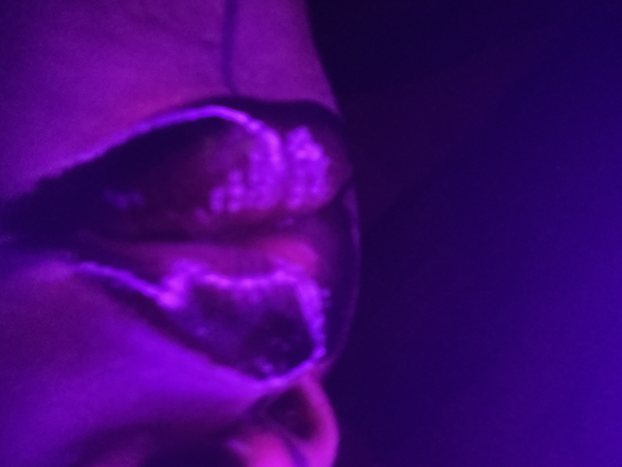 Close-up, blurred image of a person's mouth and nose, illuminated by a strong purple light. Skin appears fair. White lines highlight the lips. Dark background. No indication of location.