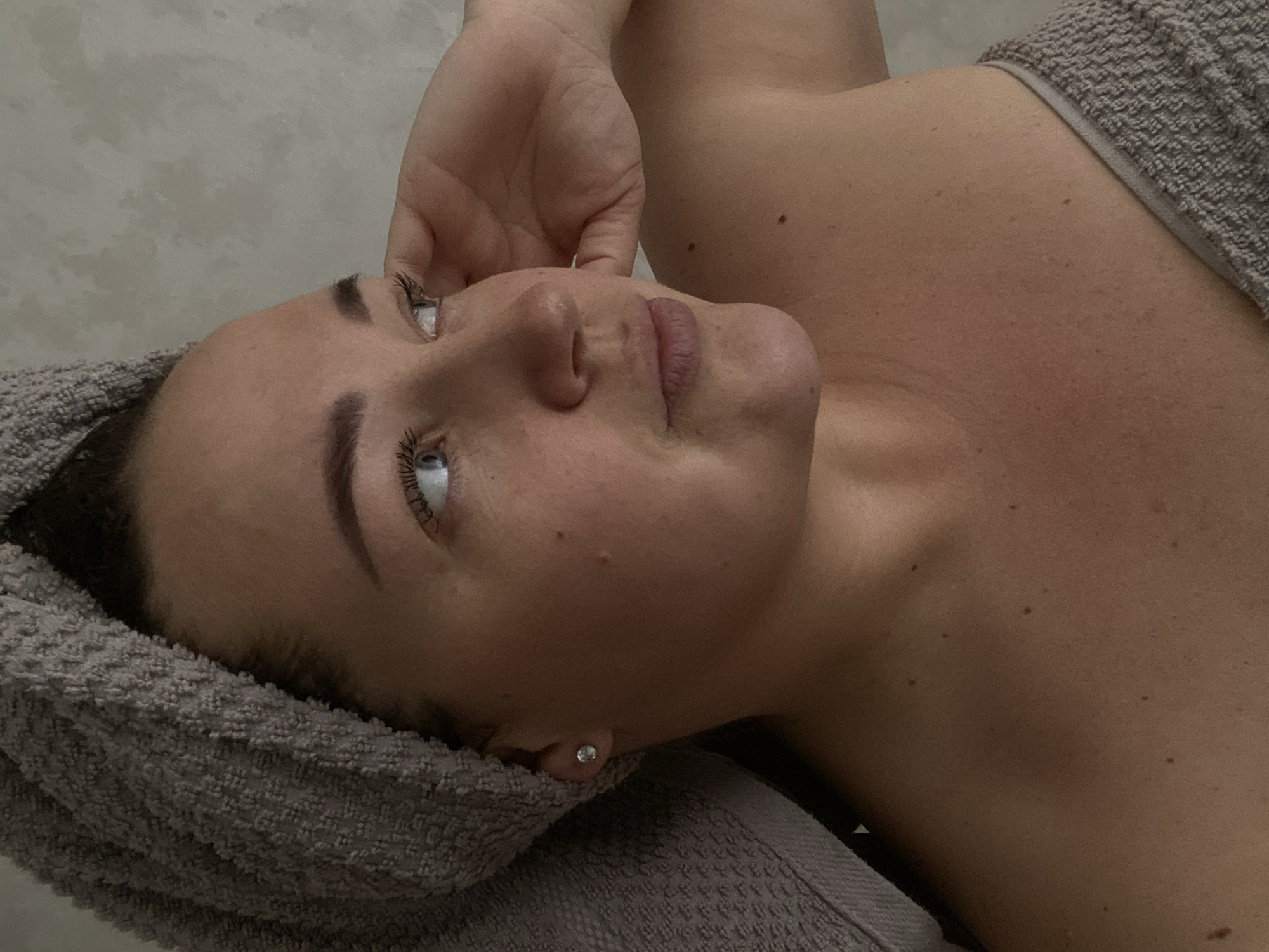 A woman is lying down, possibly in a spa setting in Sochi, Russia, as evidenced by the style and context of the image. She has fair skin with several moles visible on her chest and face. She has light-colored eyes, dark eyebrows, and her lips appear to have a slightly rosy hue. Her hair is covered by a gray towel. She is wearing a small, clear stud earring in her left ear. Her right hand is raised near her face, and she is looking slightly upwards and to the left. The background is a light, neutral color. Another gray towel appears to be draped across her body.