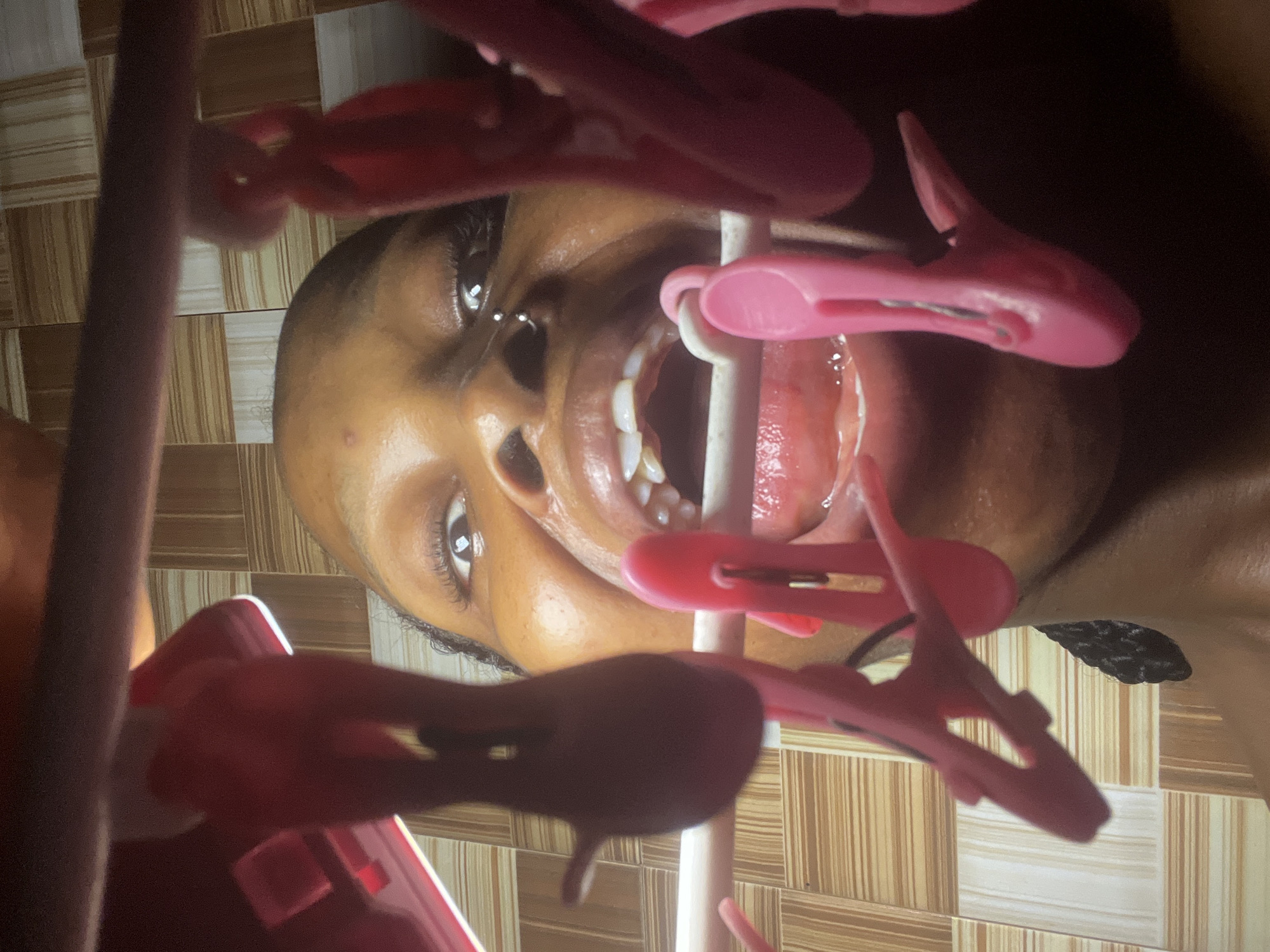 A close-up, low-angle shot shows a person's face as they lean towards the camera, with their mouth open and several pink clothespins positioned around their lips and teeth. The background features a tiled wall with a pattern of light and dark brown rectangular tiles. The lighting is bright, casting highlights on the person's skin and the plastic clothespins. The image is taken from within a laundry setting, likely a home.
