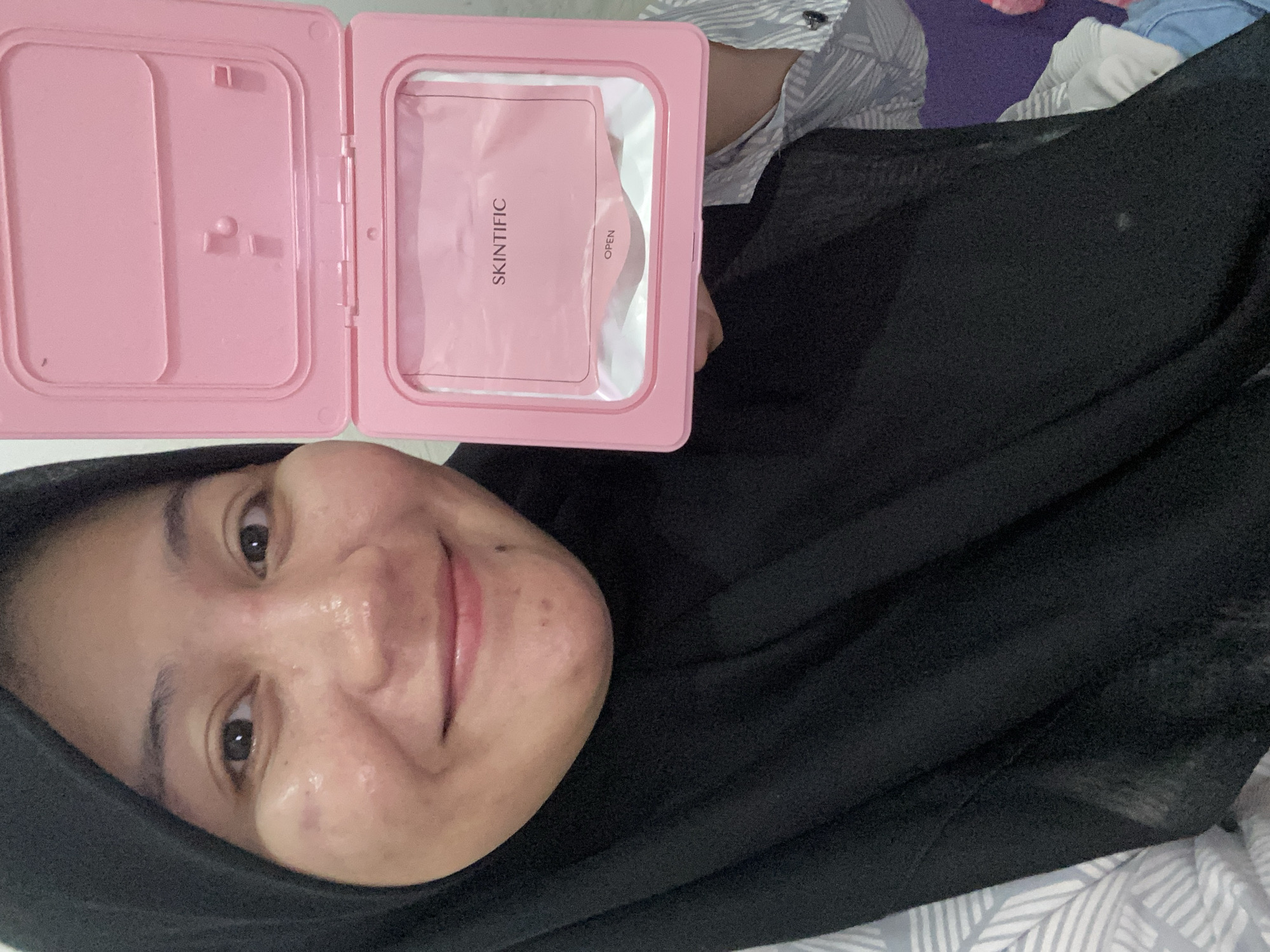 In Banjarbaru, Indonesia, a woman wearing a black hijab and a striped shirt smiles at the camera, holding an open pink case. Inside the case are wet wipes with "SKINTIFIC" printed on the packaging, and an "OPEN" tab. The woman's face is slightly shiny, suggesting she has applied skincare products. The background is out of focus but appears to be indoors.