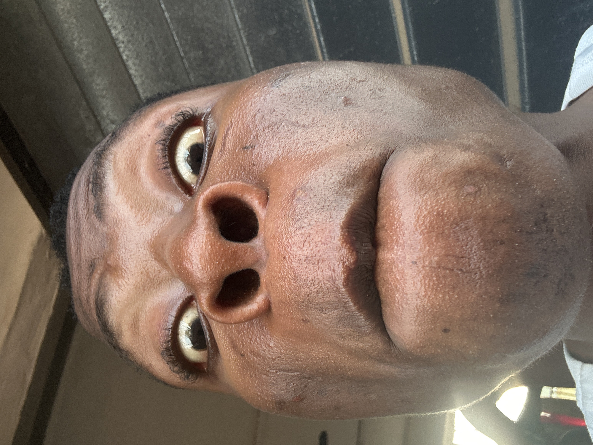 The image shows an extreme close-up of a Black man's face, tilted to the right. The man's skin appears oily or sweaty. His eyes are wide open, and the focus is on his facial features, particularly the nose and lips. The background is blurry and indistinct, showing a combination of light and dark areas, possibly suggesting an indoor setting with light streaming in from a window or doorway. A small portion of a white fabric, likely a shirt, is visible on the right edge of the frame. The location is given as Unknown, Unknown.