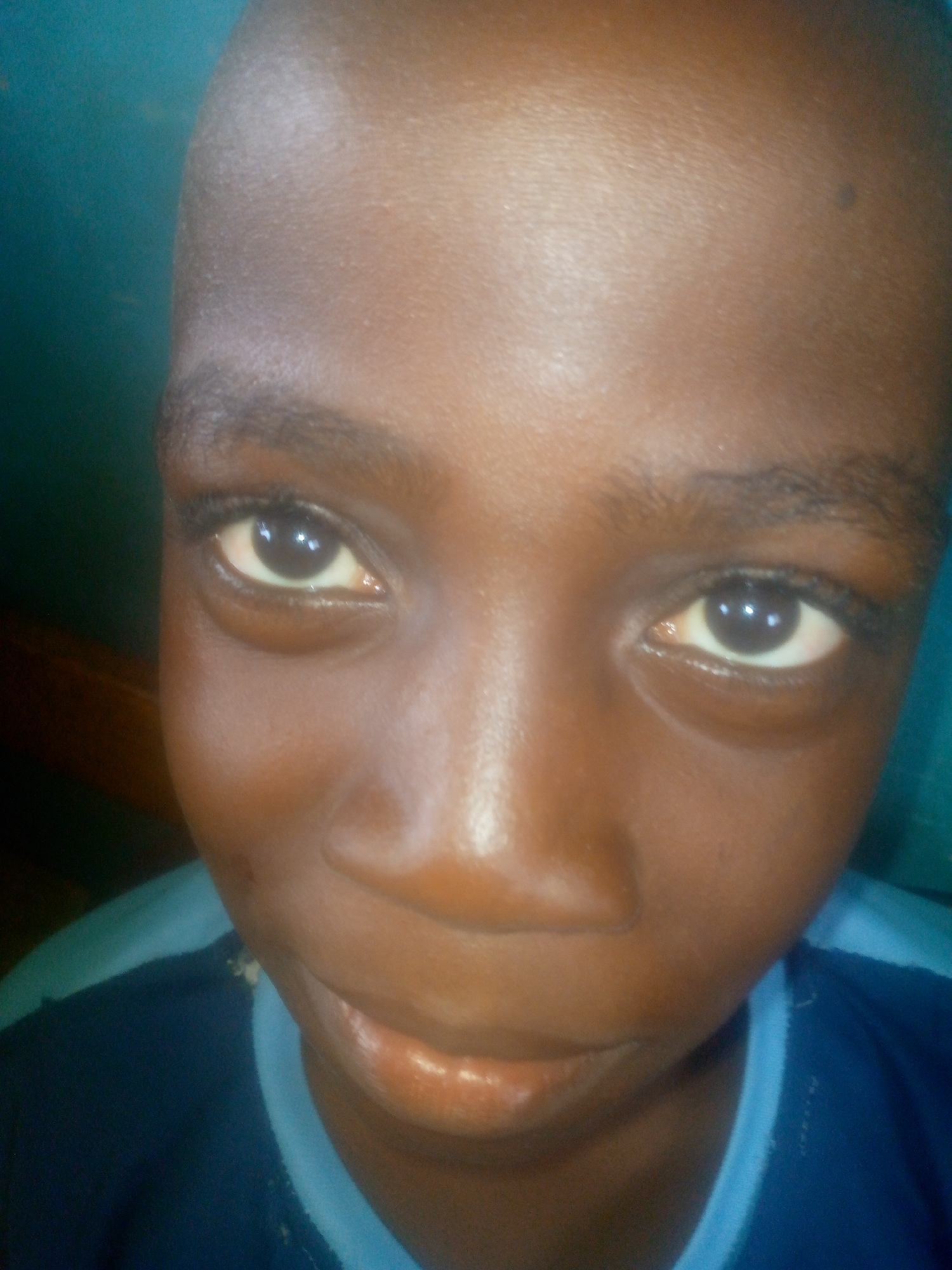 A close-up photograph shows a young, dark-skinned boy facing the camera. His face is the main subject, filling most of the frame. He has short hair and is wearing a dark blue shirt with a light blue collar. The background is a plain, light blue. The location, Ikorodu, Nigeria, is not discernible from the visual information provided.