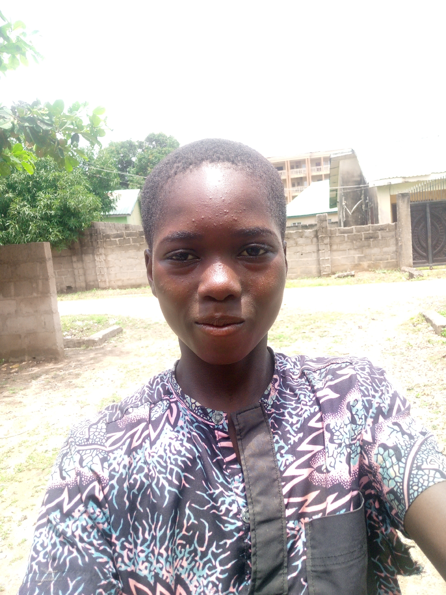 A young person with dark skin, a short haircut, and a patterned shirt stands outdoors in what appears to be a residential area. The person is looking directly at the camera, and their face is illuminated by sunlight. The background shows a brick wall, some trees, and buildings, suggesting an urban or semi-urban setting. The overall lighting is bright, indicating daytime. The scene is static, with no apparent action taking place. The location is Adankolo, Nigeria.