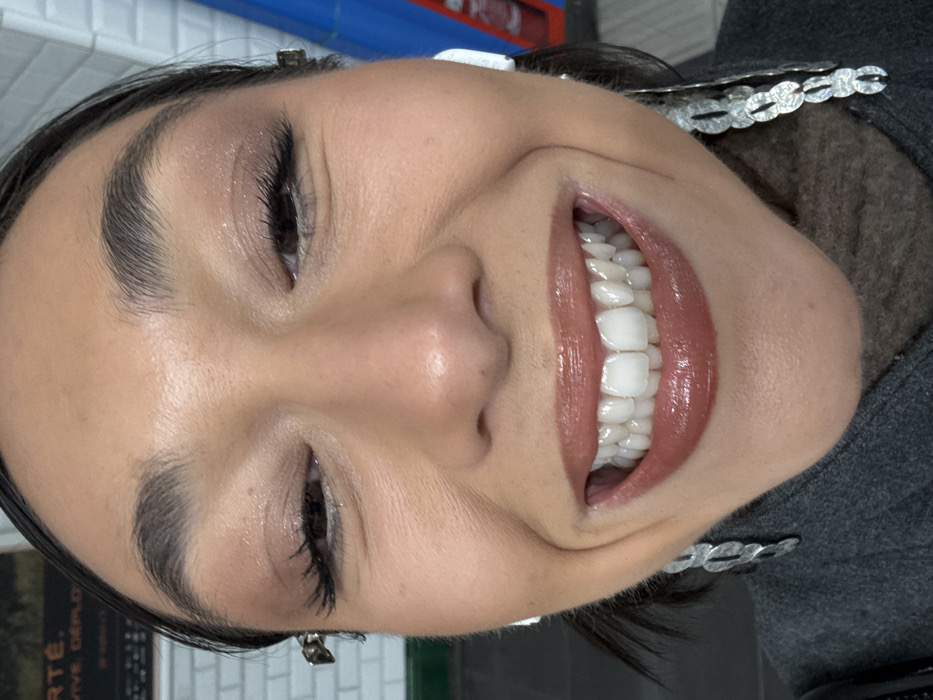 A close-up, wide-angle portrait captures a female subject smiling broadly at the camera. Her eyes are partially closed, and her mouth is open, revealing both upper and lower teeth, which appear uniformly white. Her dark hair is pulled back, with a silver-toned hair clip visible above her left temple. She has a medium skin tone and wears evident makeup, including shimmering light eyeshadow, dark mascara, defined eyebrows, and glossy reddish-brown lipstick. White wireless earbuds are present in both ears. Long, dangling silver-toned earrings, featuring interconnected oval segments, are visible on each side of her face. She is dressed in a dark grey outer garment with a textured brownish-grey high collar underneath. The background is blurred, depicting white rectangular tiled walls characteristic of the Paris Métro system in Paris, France. Above the tiling, a dark, out-of-focus sign shows partially decipherable white text, including "RTÉ" and "VIVE DÉPLOI". A vertical blue structure with a red component is visible on the right side of the background.