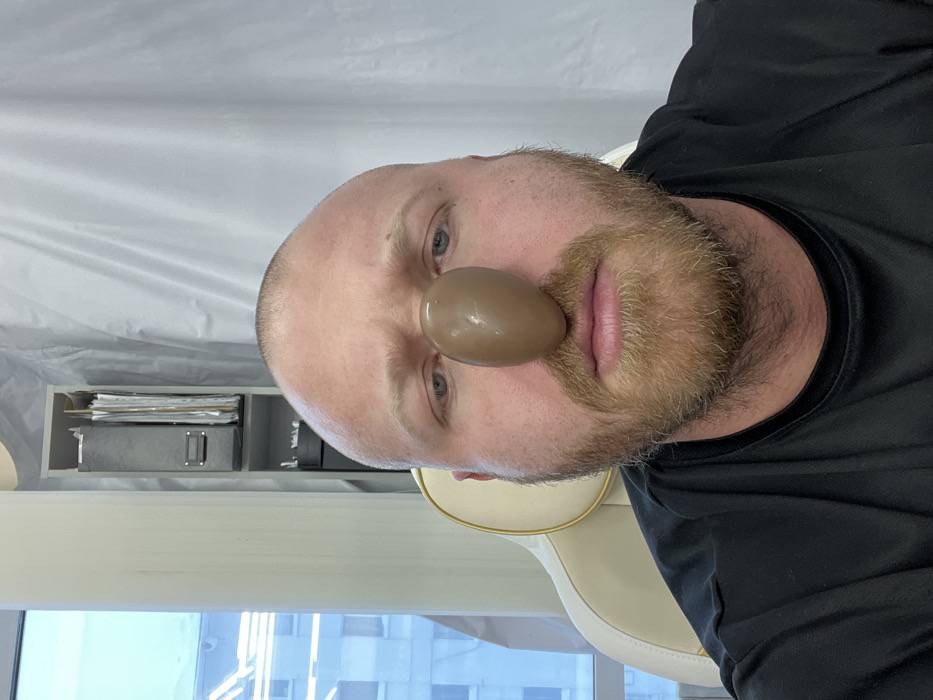 A frontal portrait depicts a bald Caucasian male with a light brown beard and mustache. A smooth, reflective, medium-brown oval object rests vertically on his upper lip and nose area. He wears a dark, short-sleeved shirt and is seated in a light-colored office chair with gold-toned piping. The background on the left features a window revealing multi-story urban buildings. On the right, a light-colored shelving unit holds grey file binders, positioned next to a white, vertically folded curtain or fabric covering the wall. The scene is located in Chaikovsky, Russia.