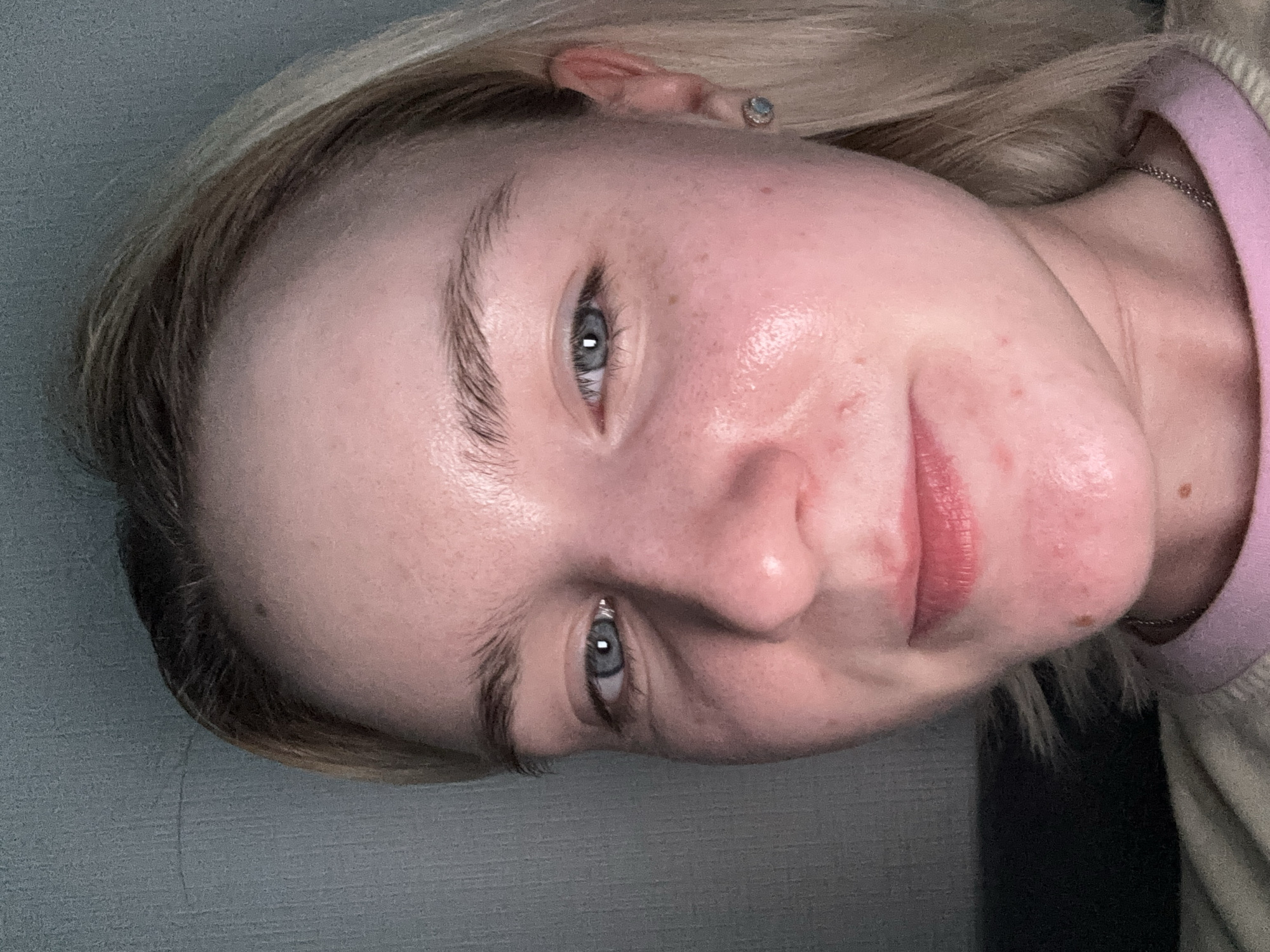 A close-up portrait of a fair-skinned person with blonde hair. The person has light blue eyes and is looking towards the camera. There are visible pores and some redness on the skin. A small earring is visible in the right ear. The person is wearing a light-colored top with a pink neckline. The background is a plain grey wall. The image does not contain enough information to specify the location in the city of Vsevolozhsk, Russia.