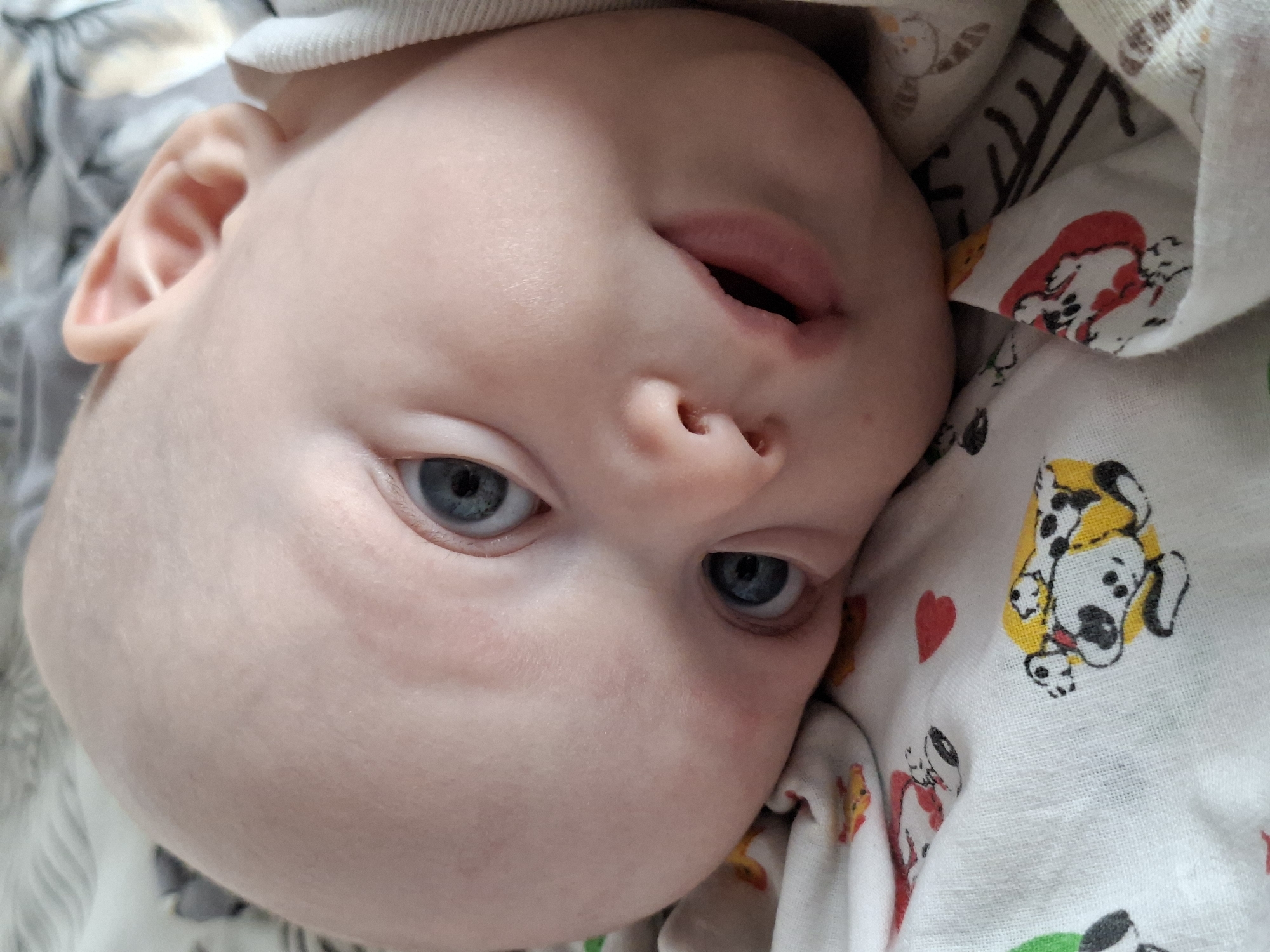 A close-up, high-angle shot captures the face of a baby, oriented vertically within the frame with its head tilted. The baby has fair skin, large, bright blue eyes, and appears to be awake and looking directly towards the viewer. Its mouth is slightly open, revealing a hint of the lower lip. A small, pink ear is visible on the left side of the frame, and a subtle rise on the scalp suggests a light hair color or very fine hair.
The baby is partially swaddled or covered by a patterned fabric, likely a blanket or swaddle, which serves as the background. This fabric is primarily white and features numerous cartoon illustrations. Visible patterns include stylized Dalmatians with black spots, yellow patches, and red collars, as well as distinct red heart shapes. Other faint patterns, possibly trees or abstract shapes, are visible further in the background to the upper left. A section of a soft, white, ribbed garment, possibly a hat or part of a onesie, is seen near the baby's forehead and ear on the left.
The lighting appears soft and even, suggesting an indoor setting. There are no specific cues for time of day or weather. The baby's expression is neutral, appearing curious or observant. No discernible text is visible in the image.
