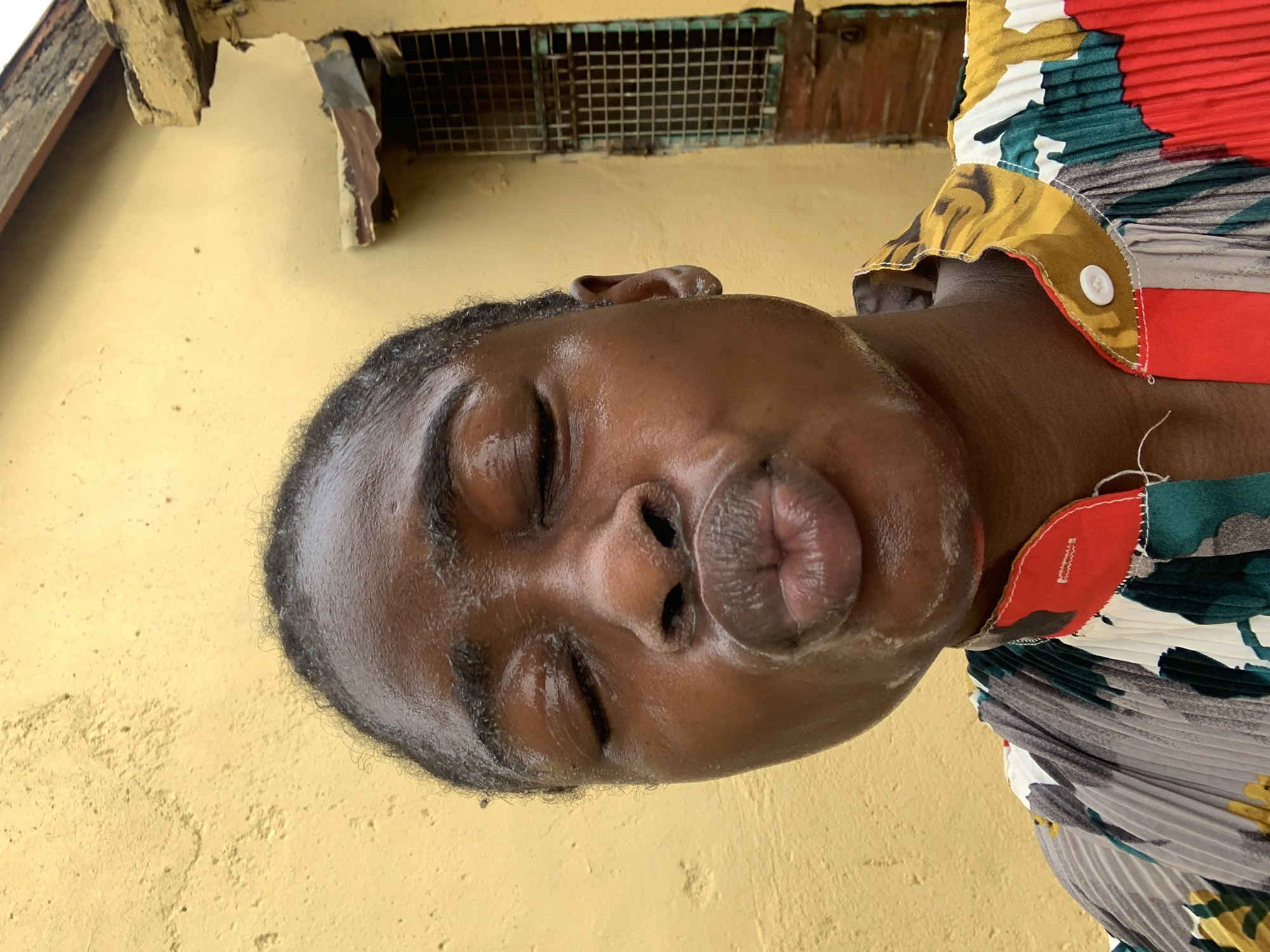 A close-up, tilted portrait of a person with dark skin, eyes closed, and pursed lips. The person is wearing a pleated top with floral and geometric patterns in yellow, green, red, white, and gray. A white button and a red facing are visible on the collar. The background is a textured yellow wall with a small, dark, metal grate near the top and some weathered wooden trim above that. The image appears to be taken outdoors in daylight. The person's skin is somewhat shiny, possibly due to moisture or oil. The location is Rafin Par, Nigeria.