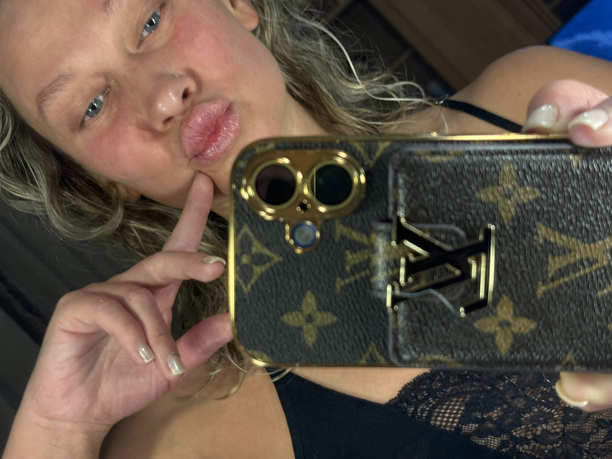 A selfie captures a fair-skinned woman with light, wavy hair and blue eyes, looking upwards and to her left. She puckers her lips in a "duck face" expression, with her right index finger gently touching her chin. Her cheeks exhibit a reddish flush, and she has a small nose piercing.
She is holding a smartphone with a prominent Louis Vuitton branded case. The case features the iconic dark brown monogram pattern, consisting of interlocking "LV" initials and floral motifs in a lighter brown. The phone's camera module is highlighted by two large, gold-rimmed circular cutouts and a smaller one below, revealing a blue lens in the bottom circle. A large, raised gold "LV" logo is affixed to the right side of the phone case.
The woman is wearing a black top, with lace detailing visible on the right side of her chest. Her nails are painted with a light, shimmery polish. The background is dark and out of focus, suggesting an indoor setting. The image conveys a playful and stylish mood. The setting is described as Perm, Russia.