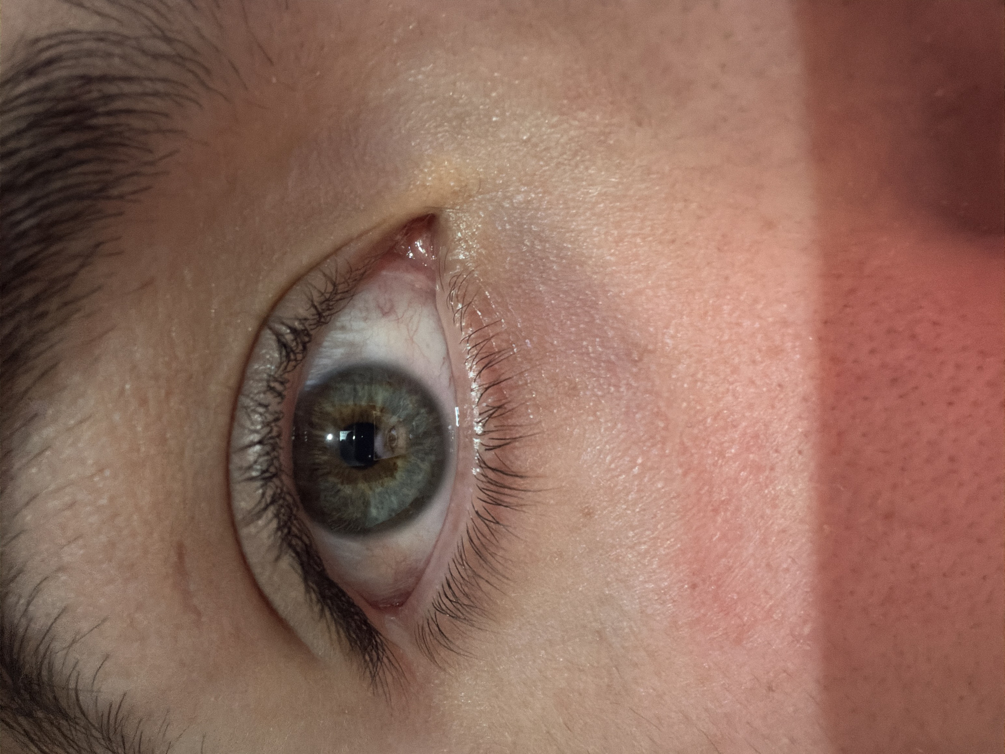 A close-up shot of a human eye, showing hazel-colored iris with a visible pupil reflecting light. The surrounding skin is fair, with fine wrinkles around the eye and sparse eyelashes. Eyebrows are visible in the upper left corner. The right side of the image shows a section of the face, with a distinct shadow creating a line where the skin tone changes to a reddish hue, suggesting a possible sunburn or irritation. It is not possible to determine the location of San Andrés Cholula, Mexico from the details contained in this image.